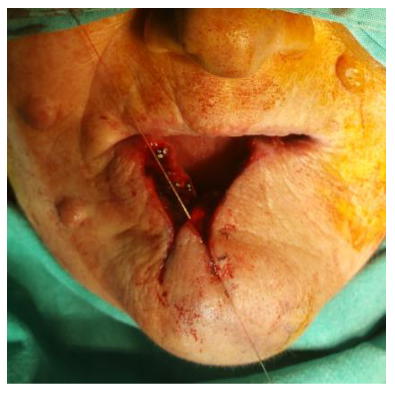 Medicina 61 00004 g024