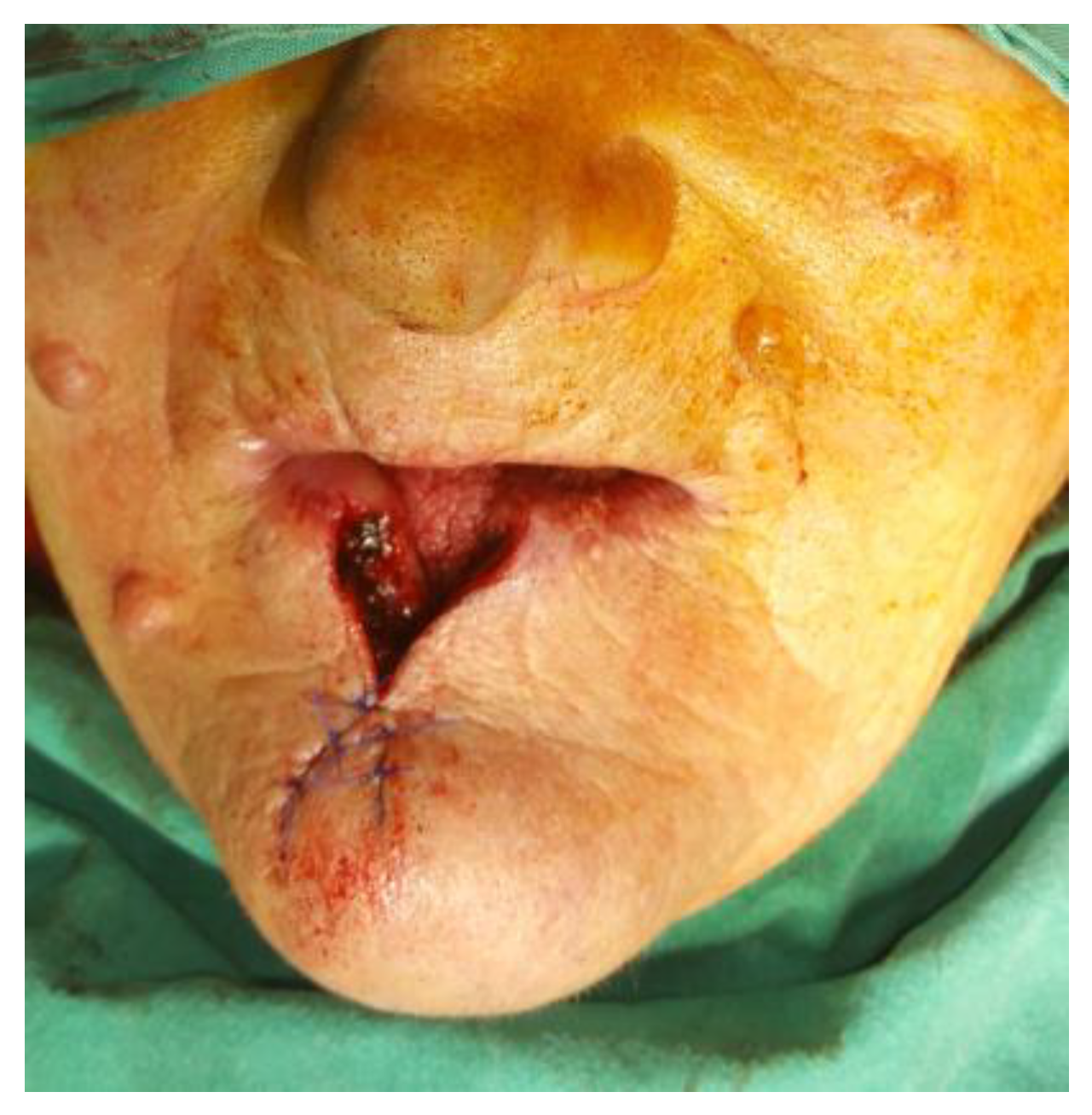 Medicina 61 00004 g025