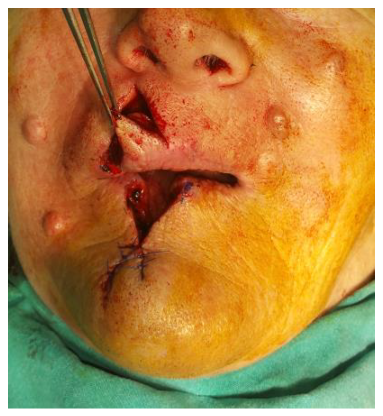 Medicina 61 00004 g027