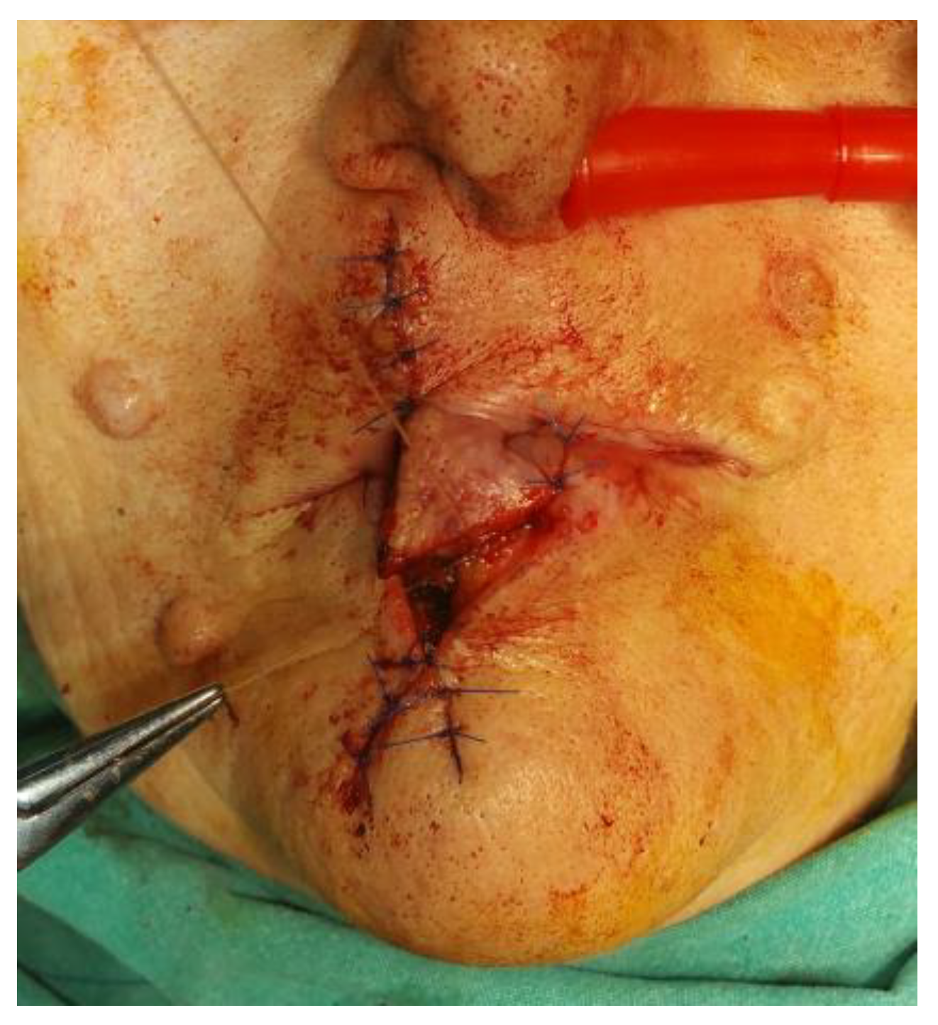 Medicina 61 00004 g028