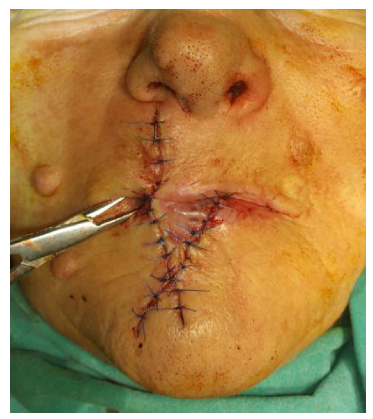 Medicina 61 00004 g029