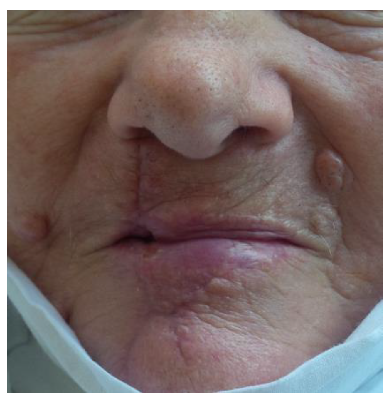 Medicina 61 00004 g032