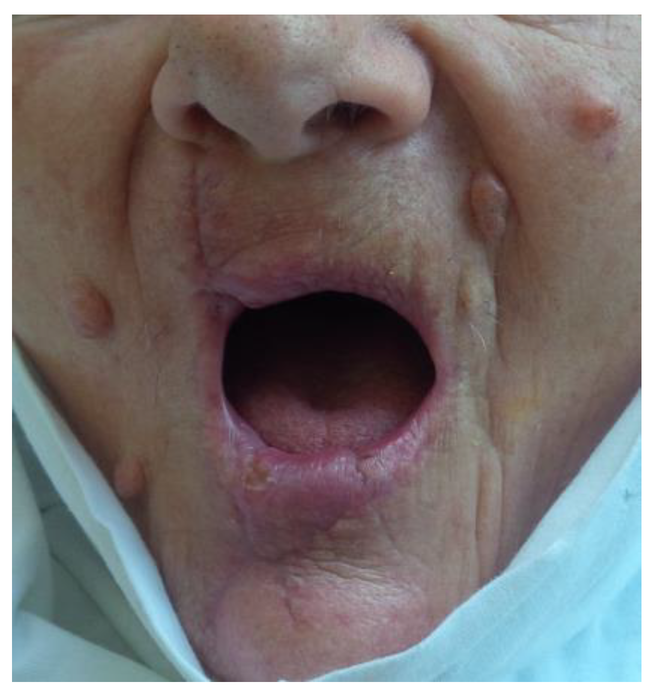 Medicina 61 00004 g033