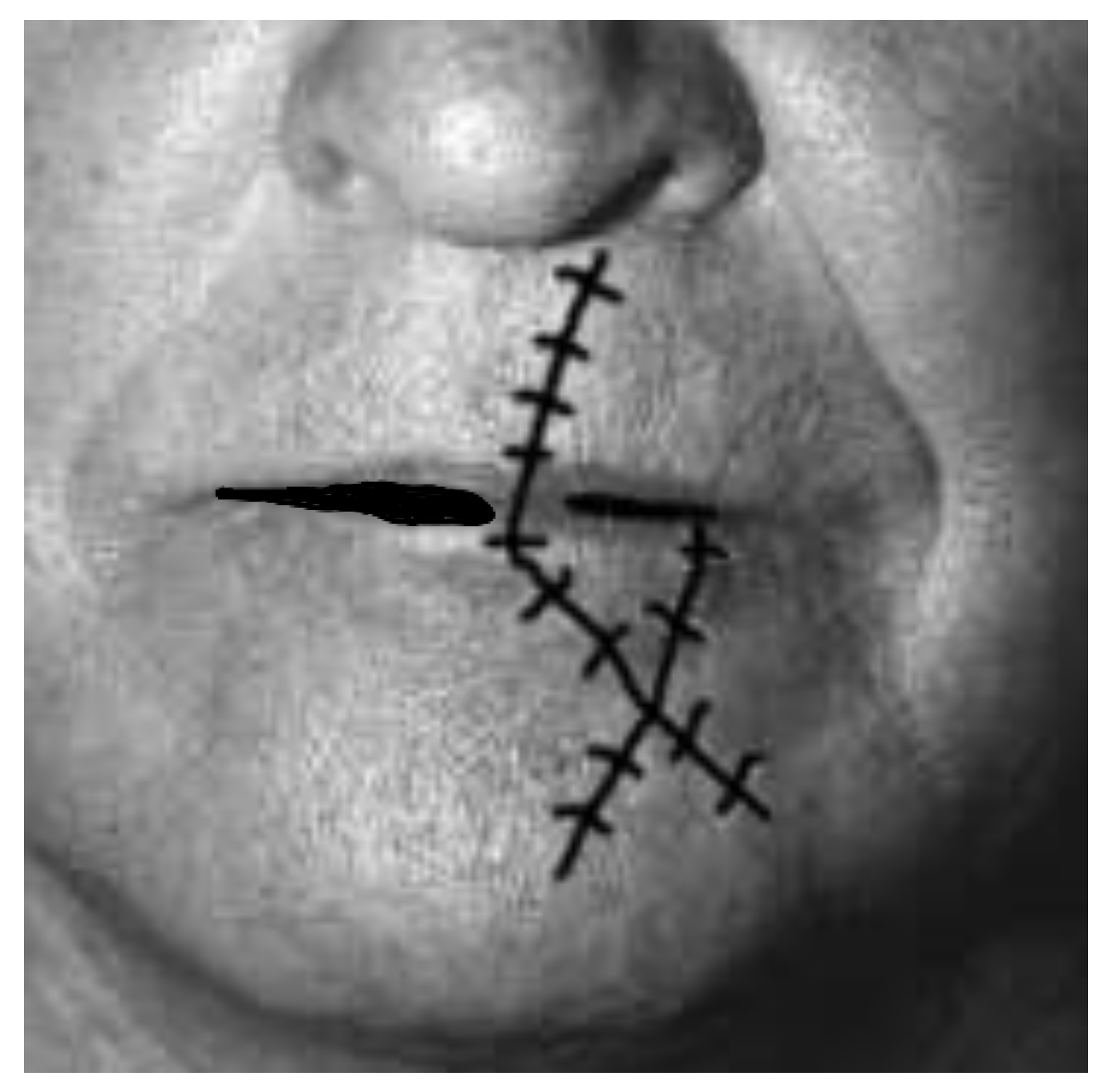 Medicina 61 00004 g034