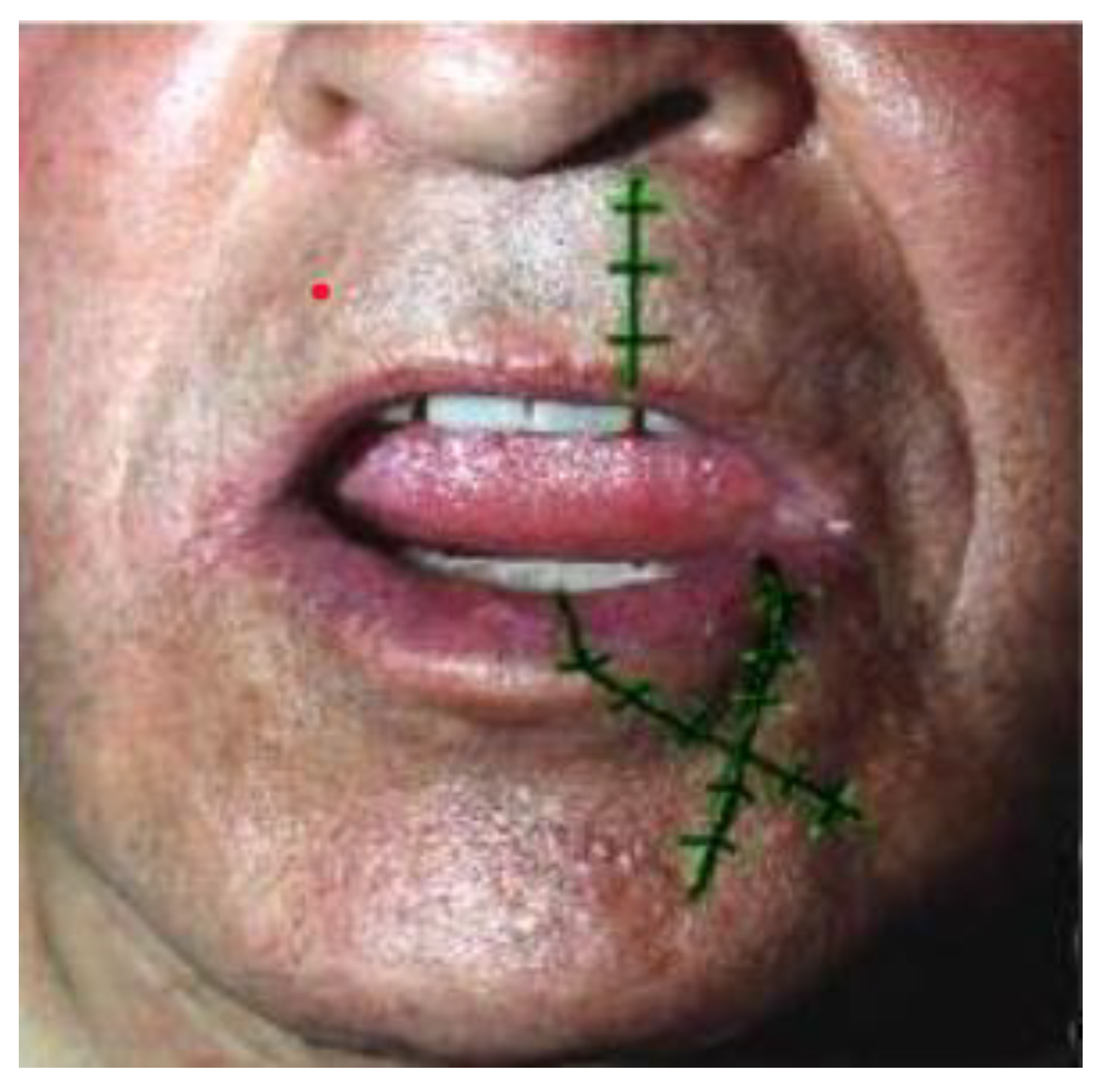 Medicina 61 00004 g035