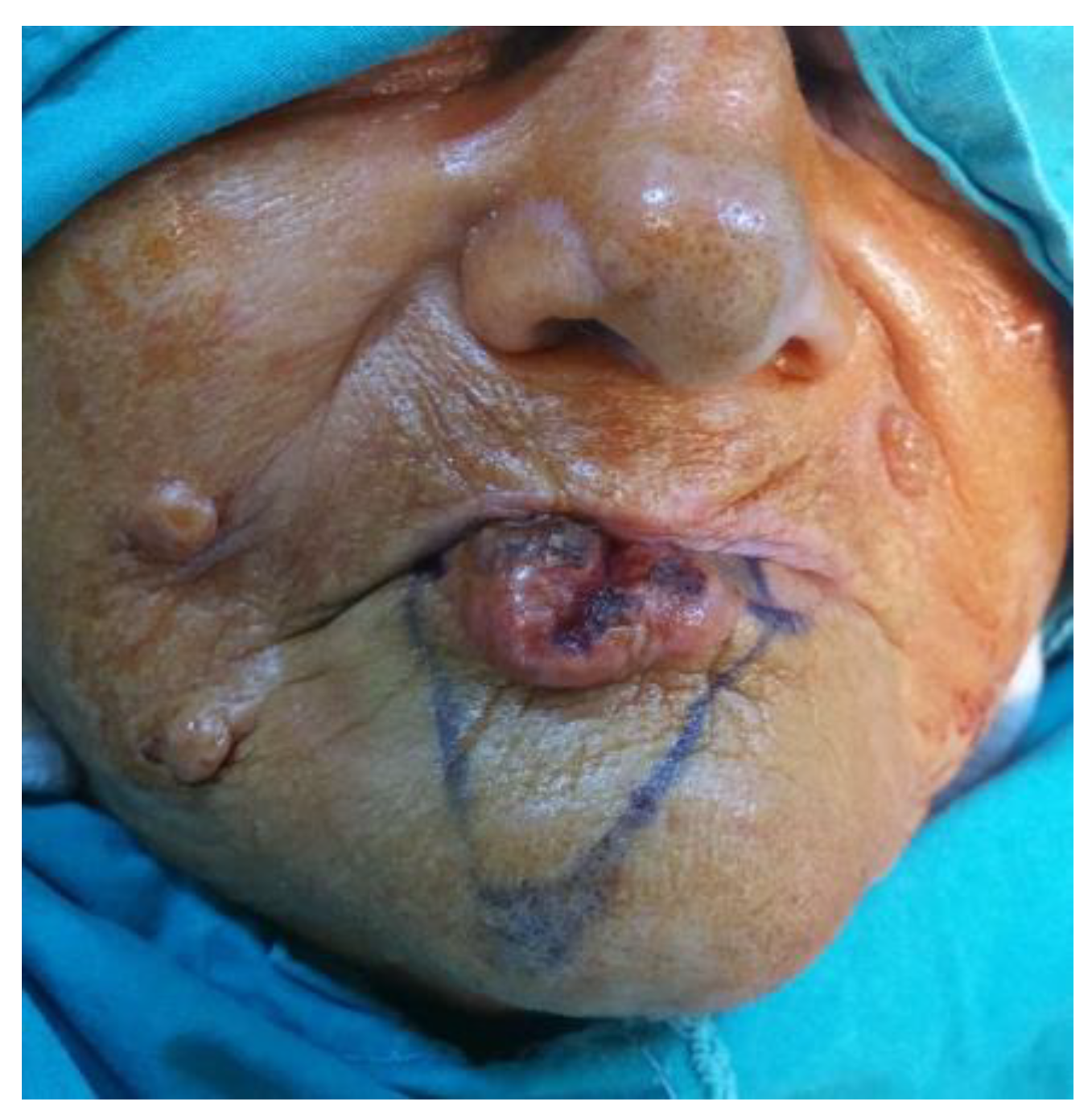 Medicina 61 00004 g036