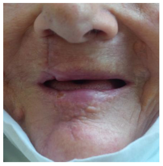 Medicina 61 00004 g037