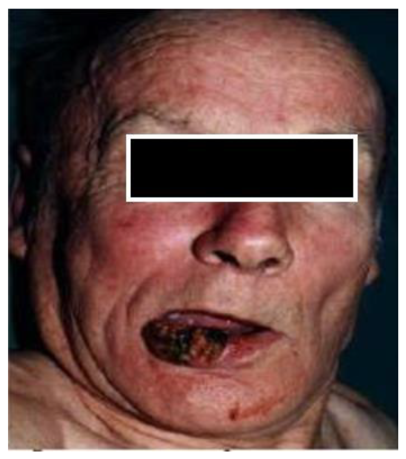 Medicina 61 00004 g038