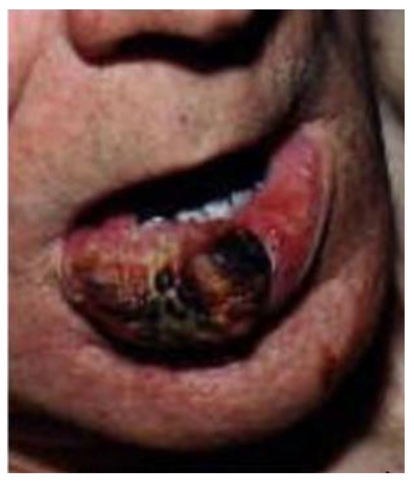 Medicina 61 00004 g039