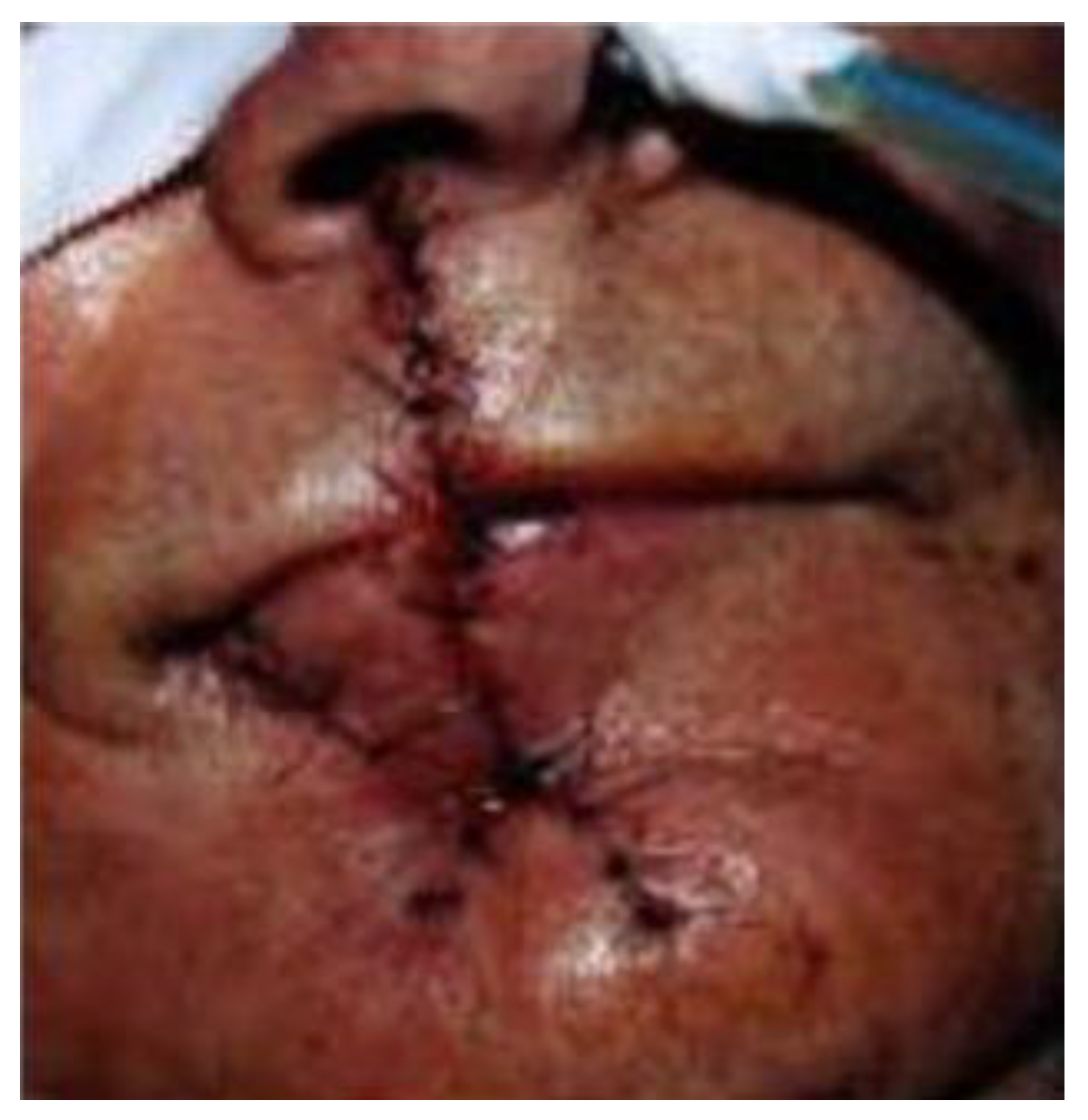 Medicina 61 00004 g040