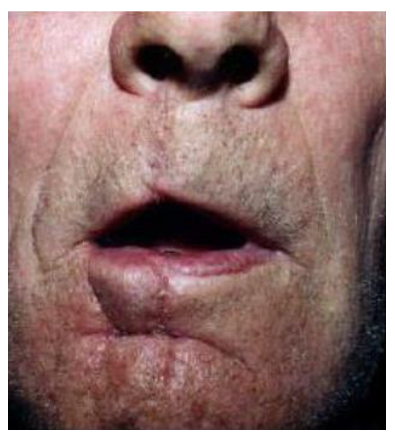 Medicina 61 00004 g042