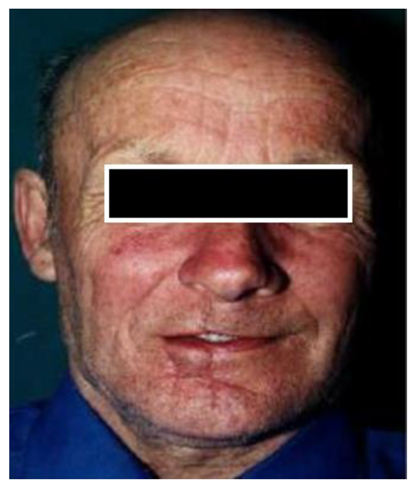 Medicina 61 00004 g045