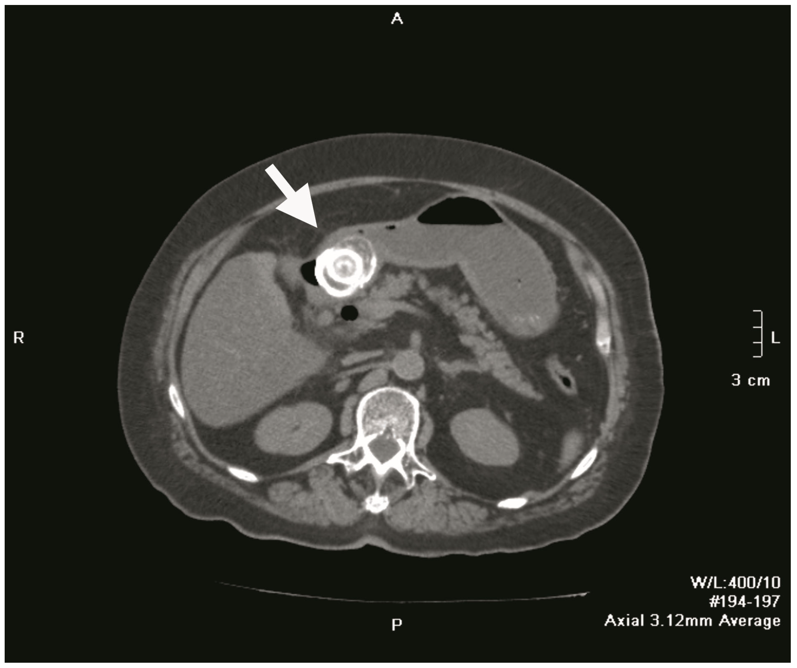 Medicina 61 00005 g001