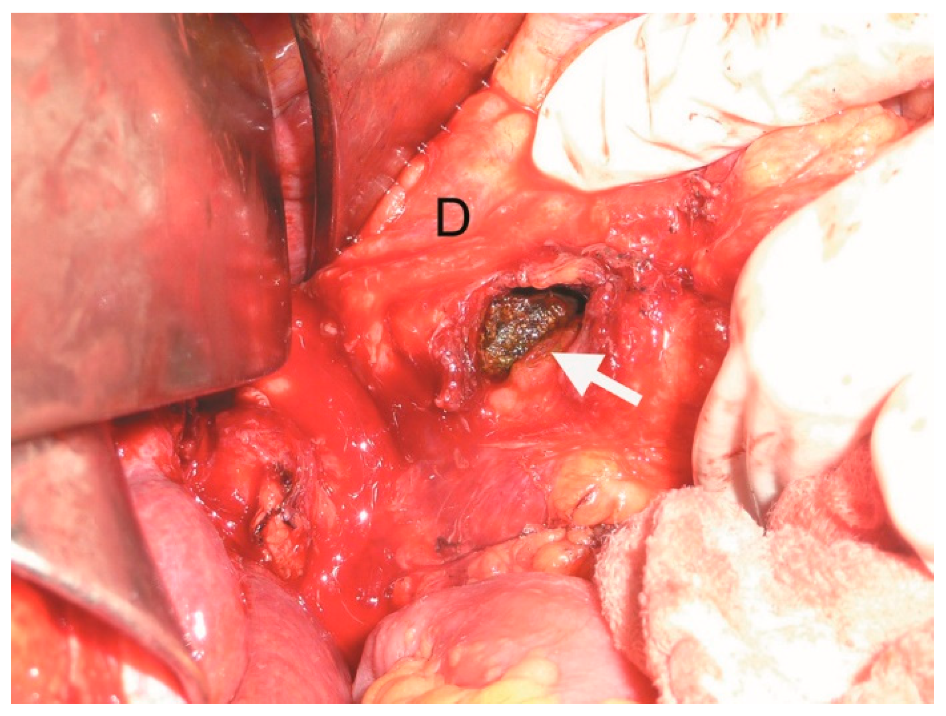 Medicina 61 00005 g003