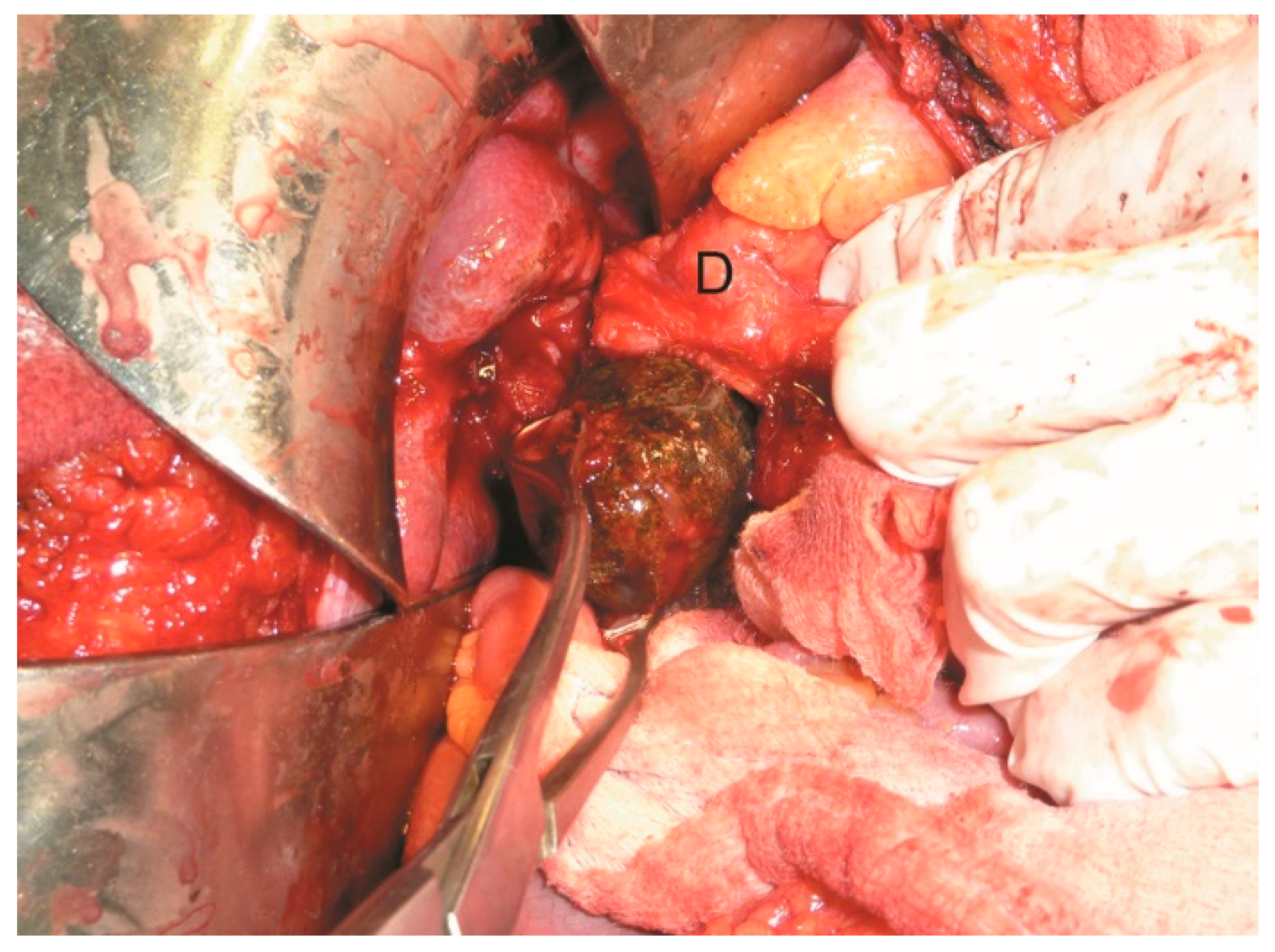 Medicina 61 00005 g004