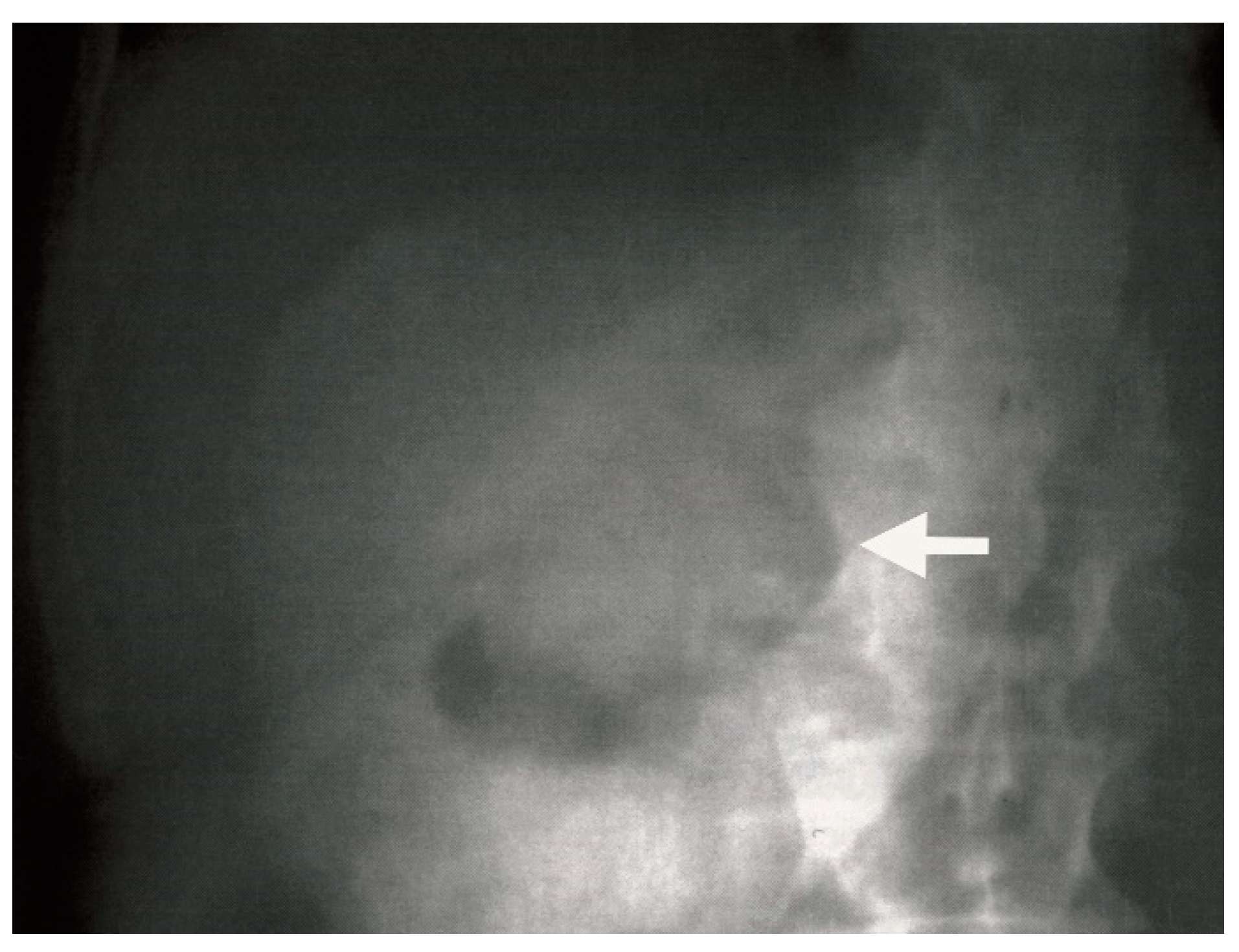 Medicina 61 00005 g006