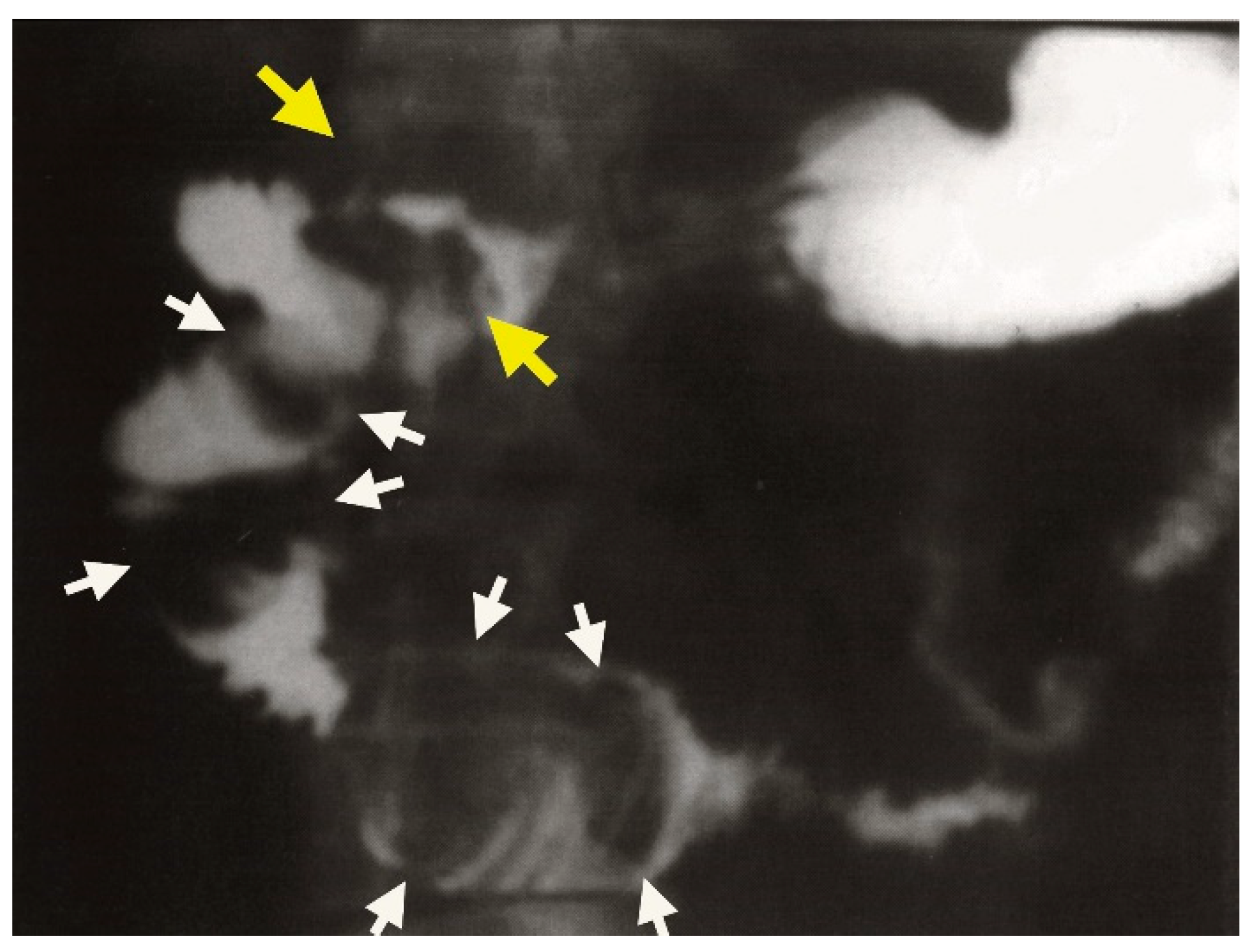 Medicina 61 00005 g007