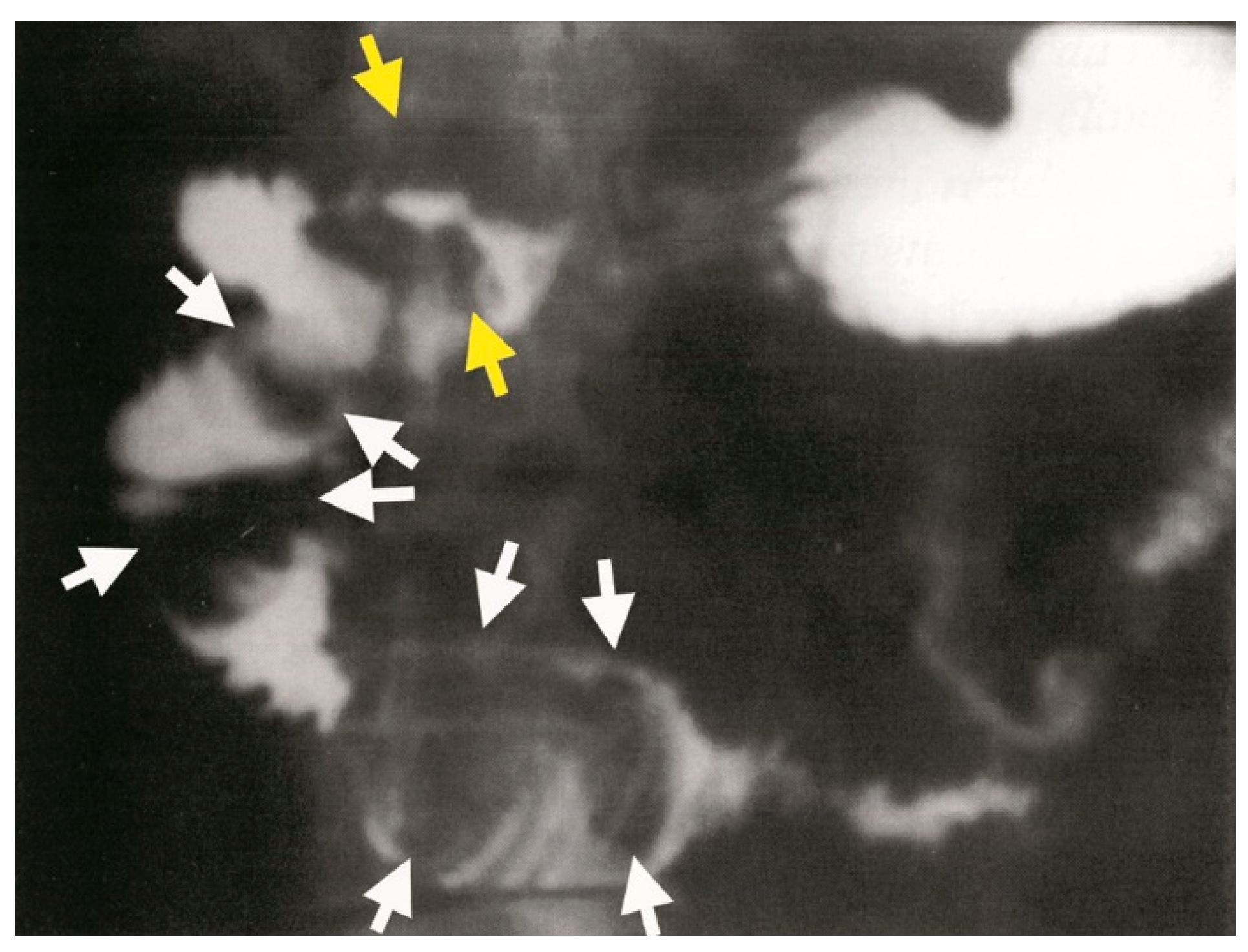 Medicina 61 00005 g008