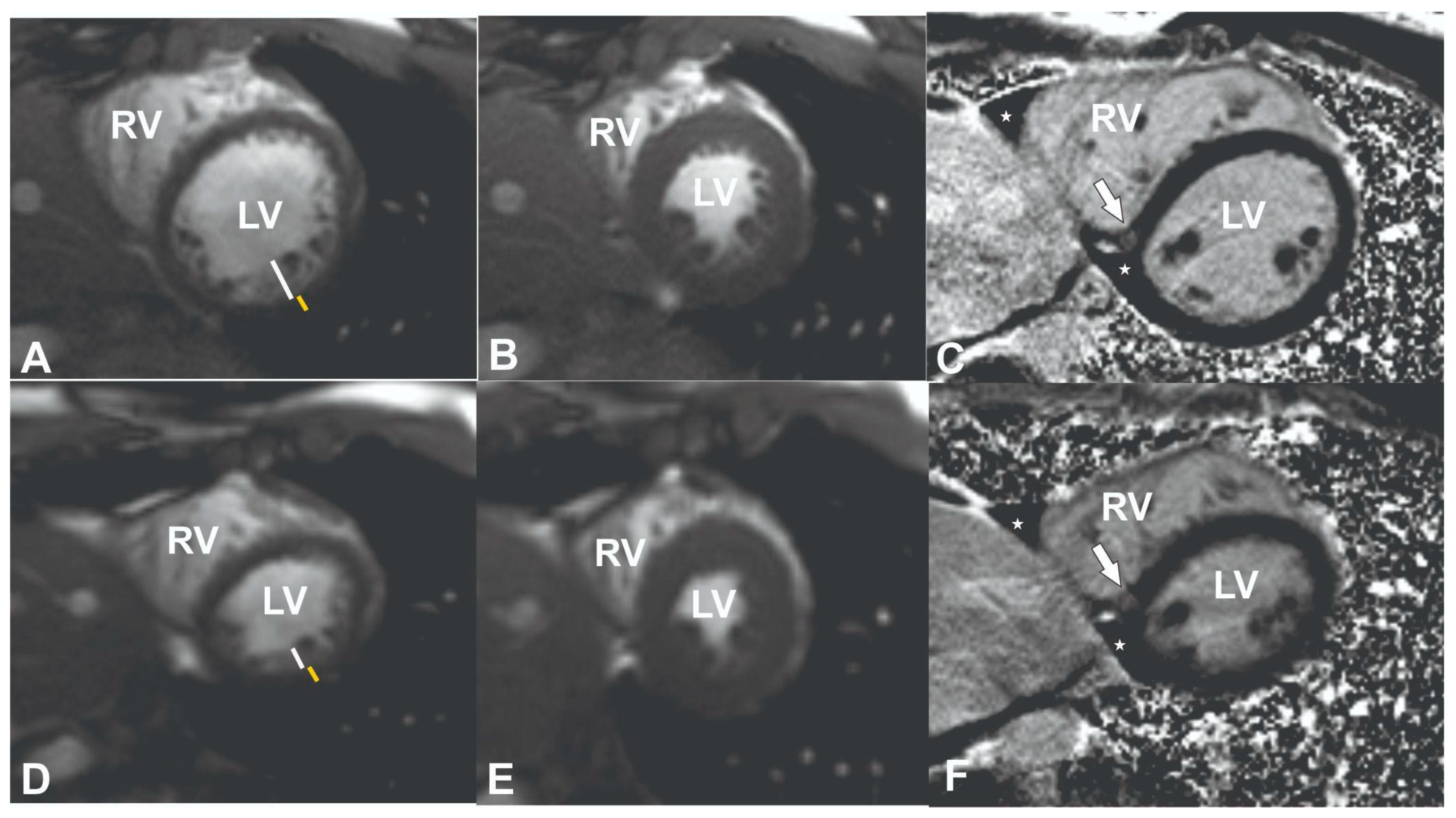Medicina 61 00032 g001