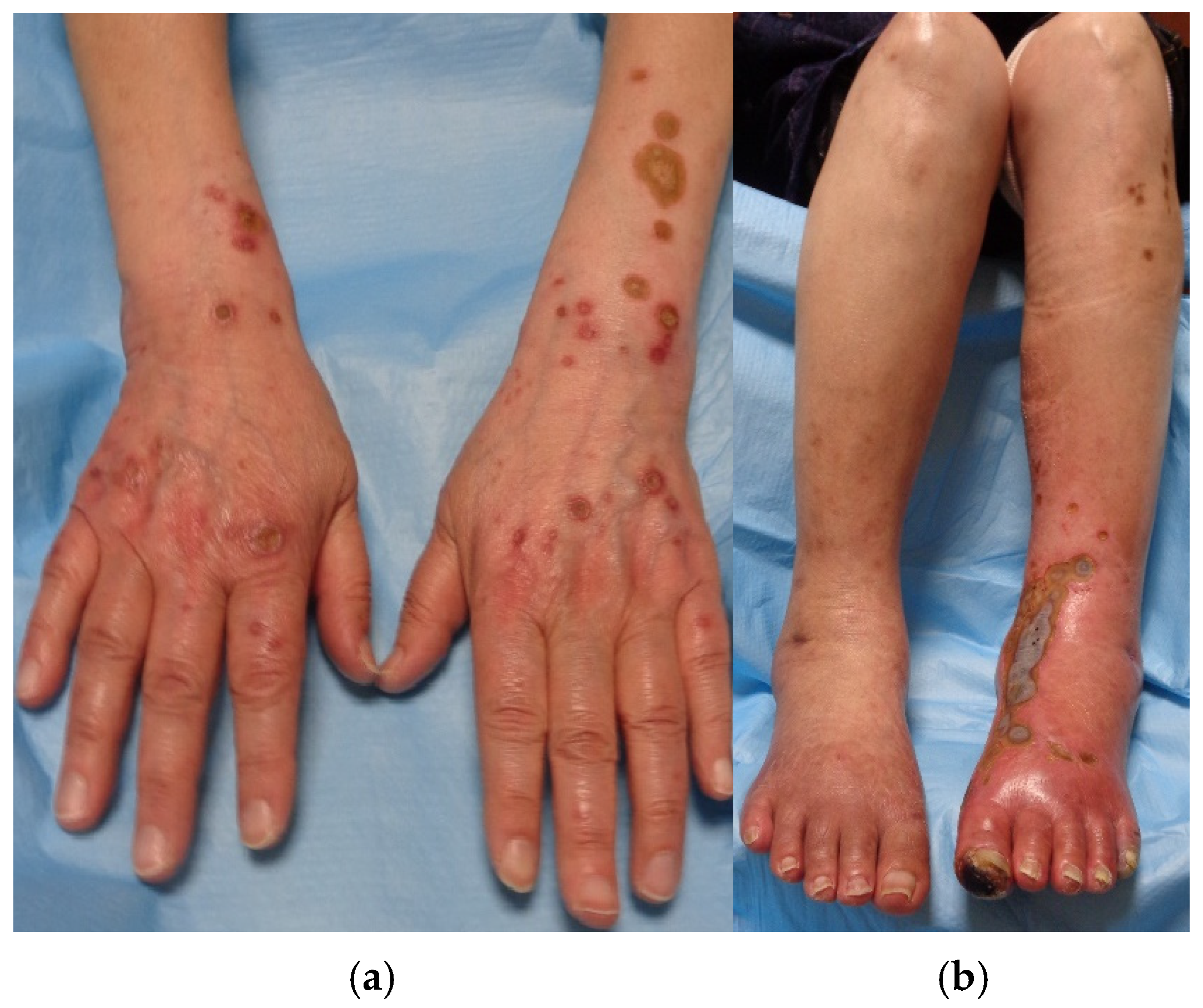 Medicina 61 00036 g001