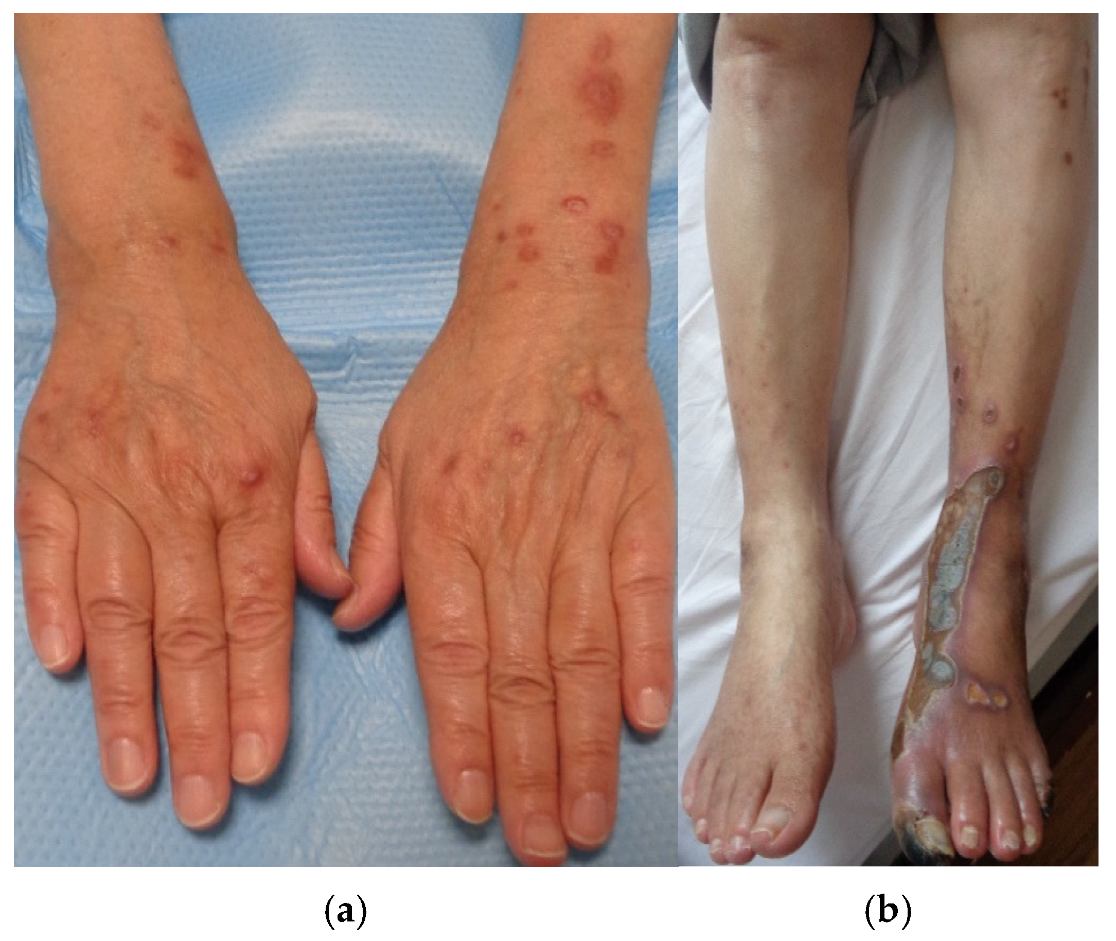 Medicina 61 00036 g004