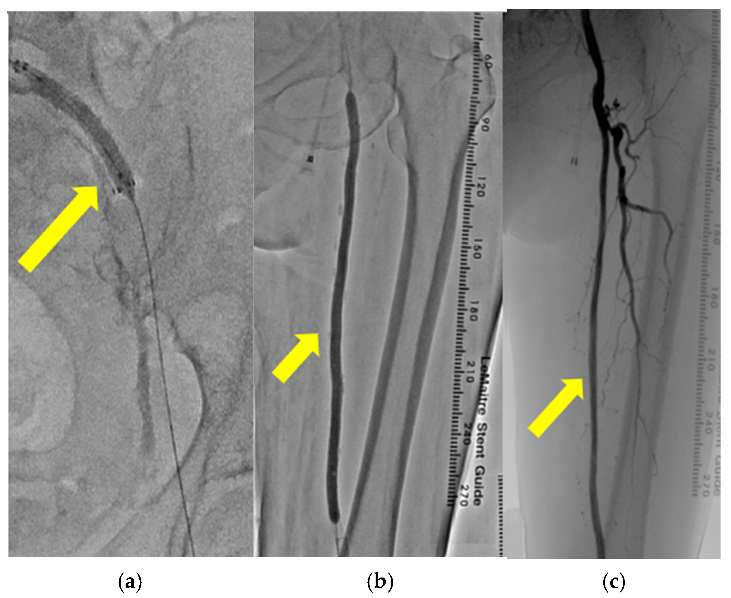 Medicina 61 00036 g005
