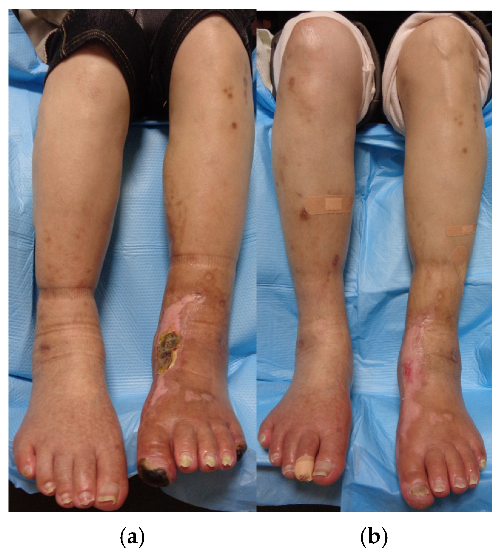 Medicina 61 00036 g006