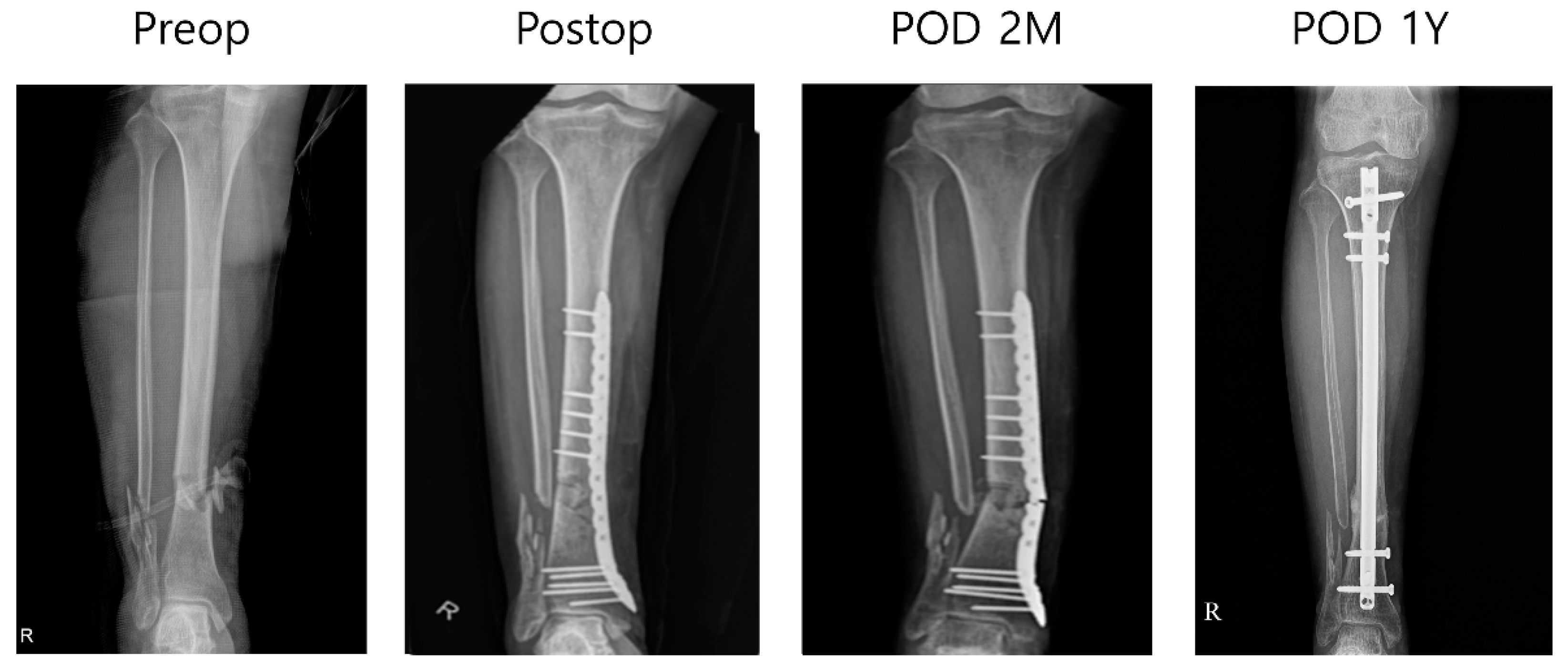 Medicina 61 00137 g004