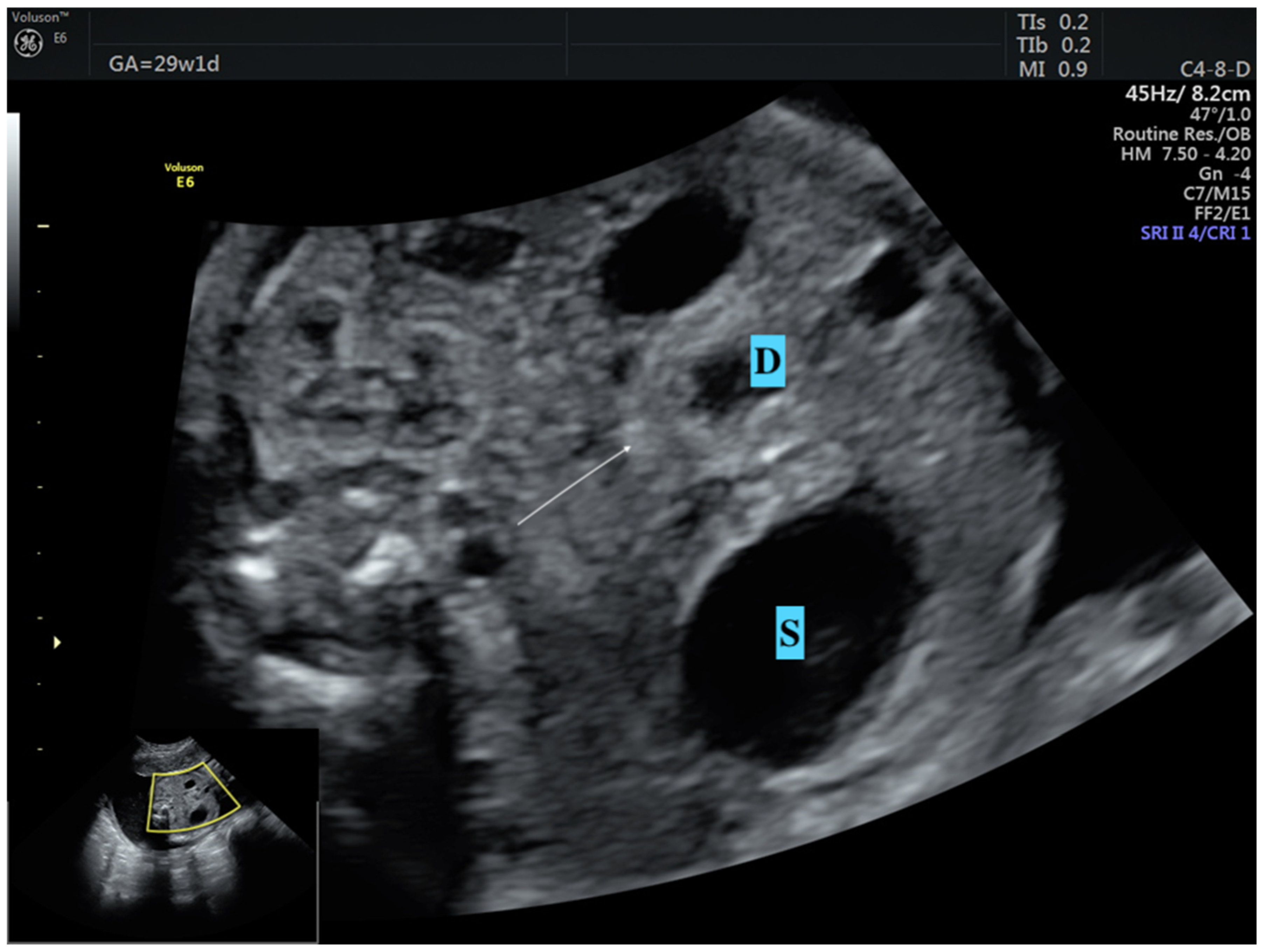 Medicina 61 00171 g002