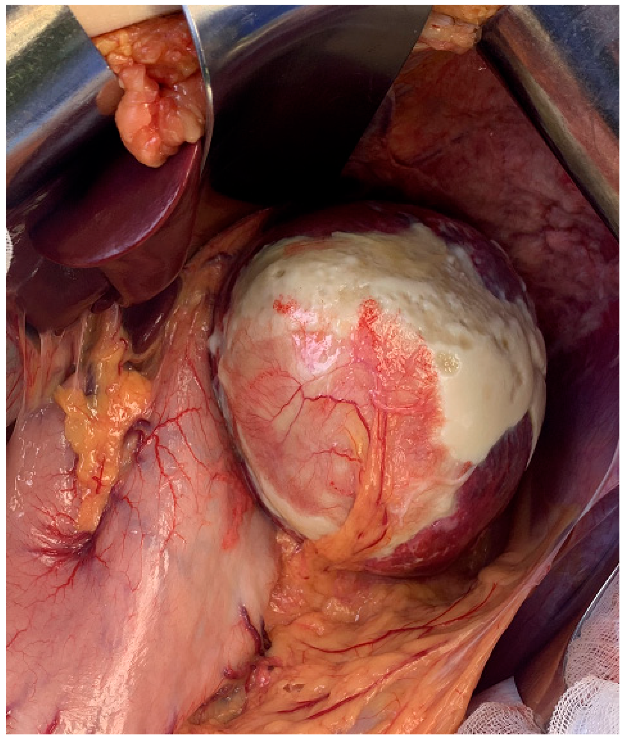 Medicina 61 00182 g002