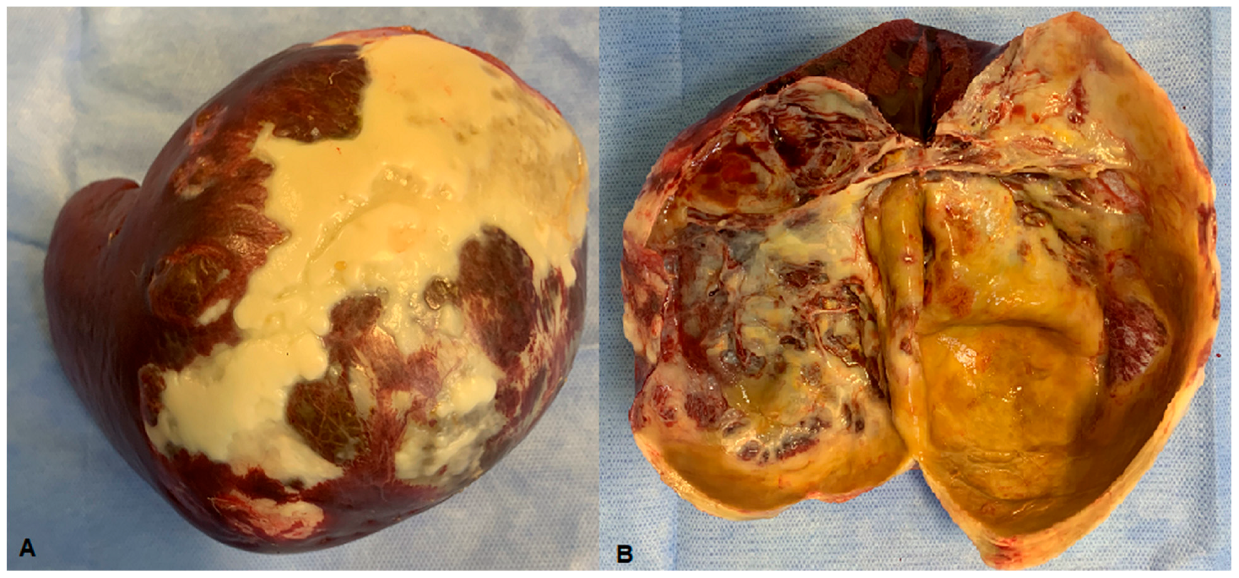Medicina 61 00182 g003