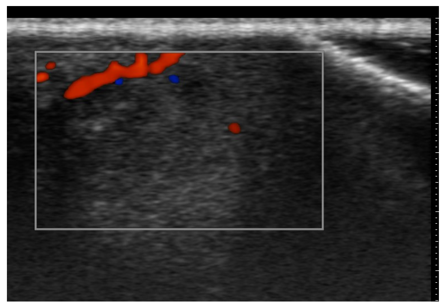 Medicina 61 00220 g002