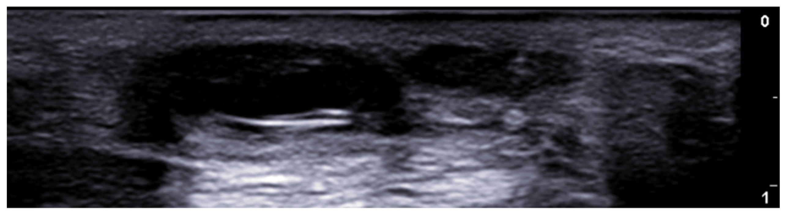 Medicina 61 00220 g023