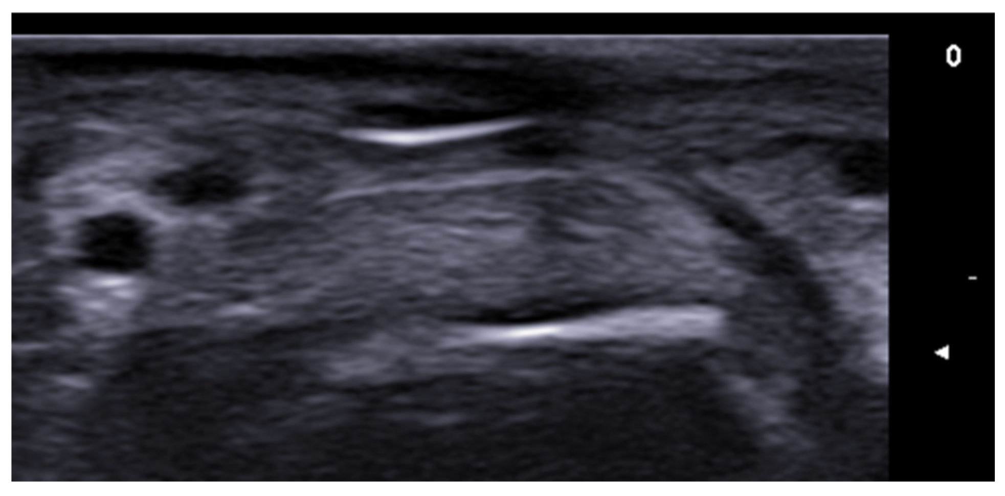 Medicina 61 00220 g032