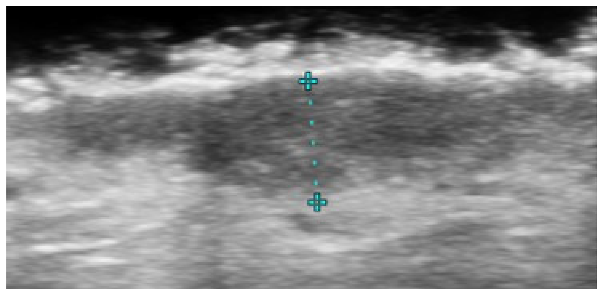 Medicina 61 00220 g035