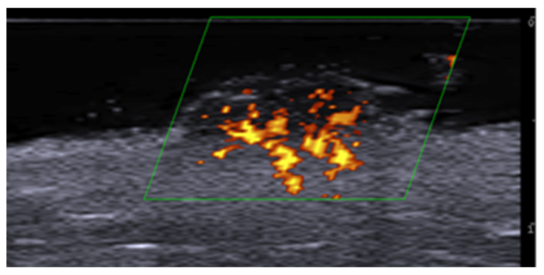 Medicina 61 00220 g036