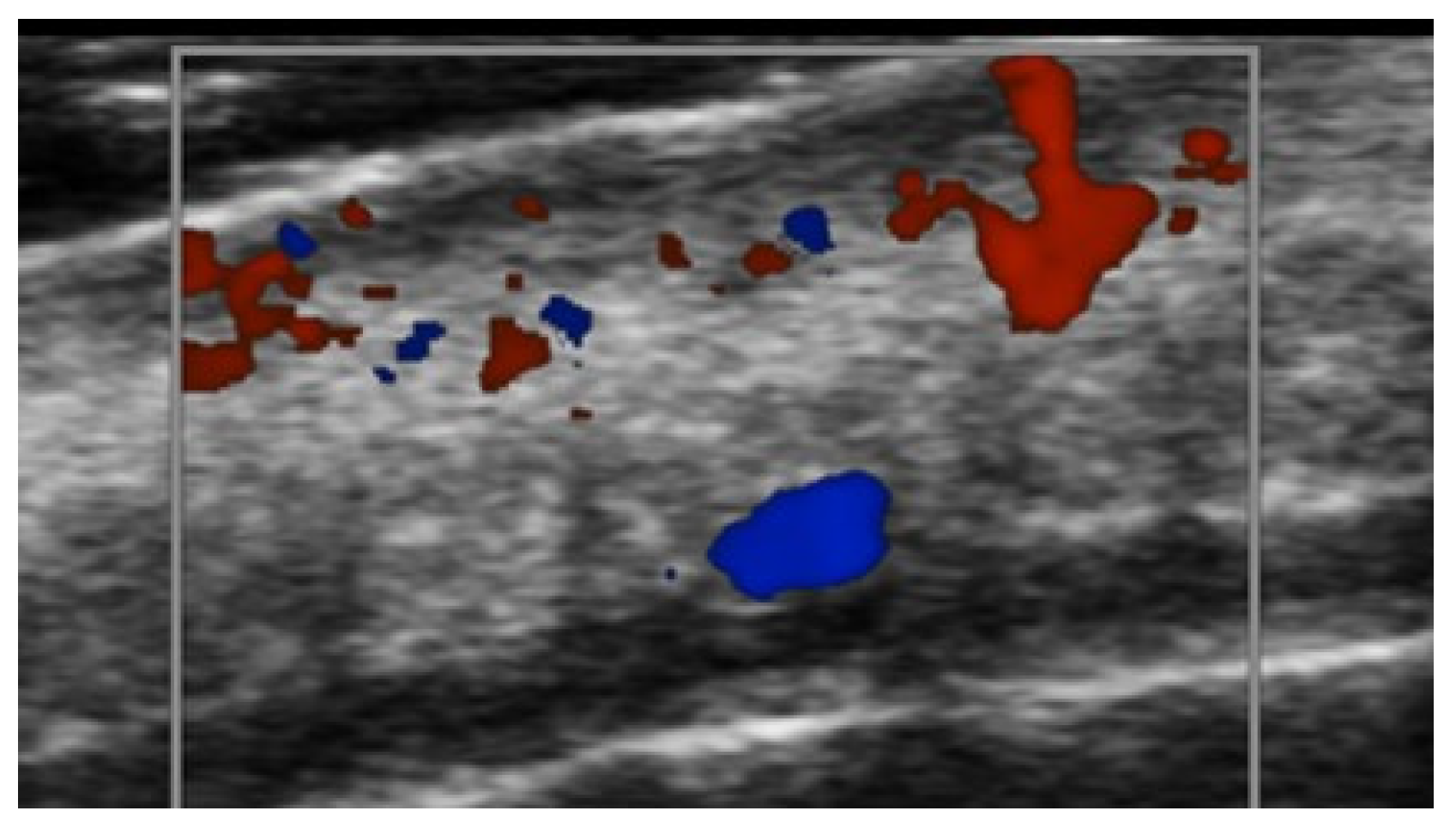 Medicina 61 00220 g037