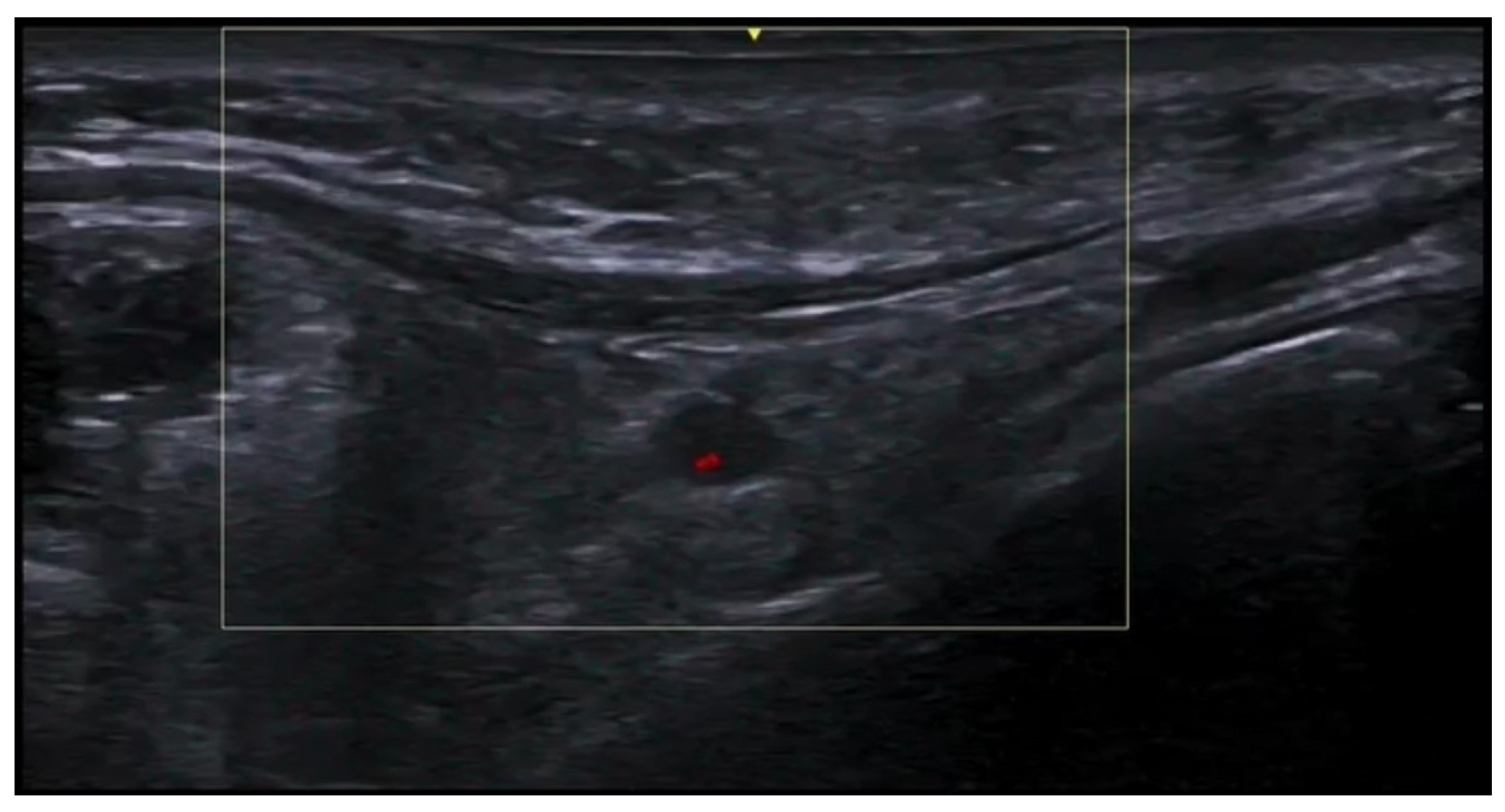 Medicina 61 00220 g057