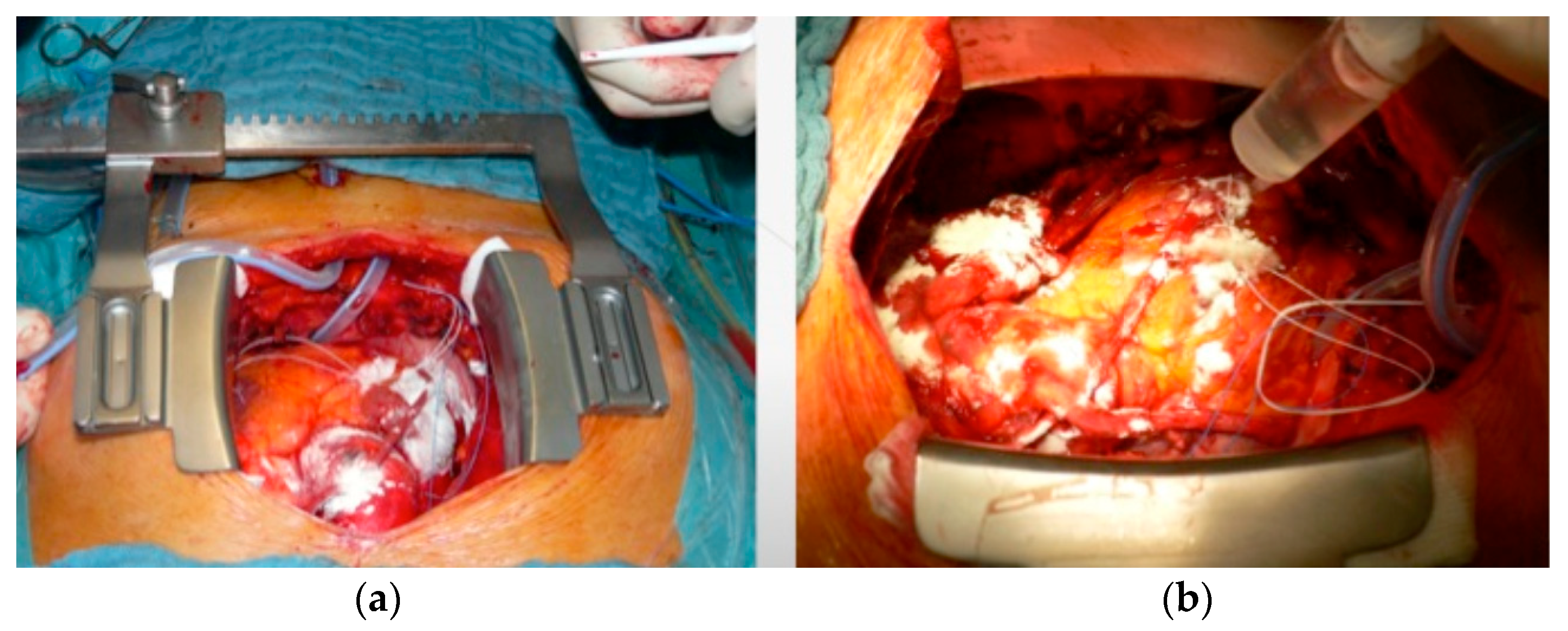 Medicina 61 00230 g003