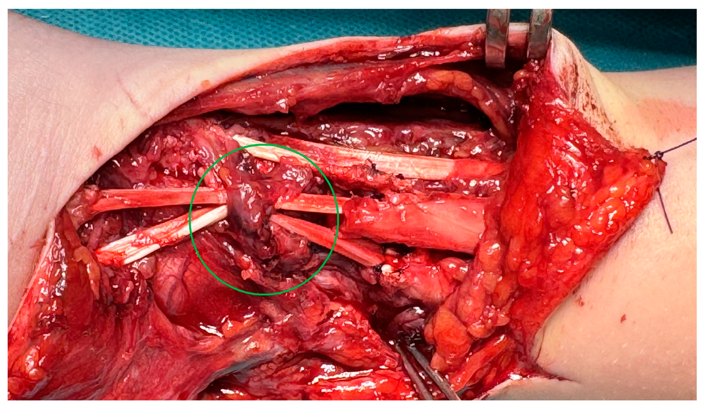 Medicina 61 00249 g004