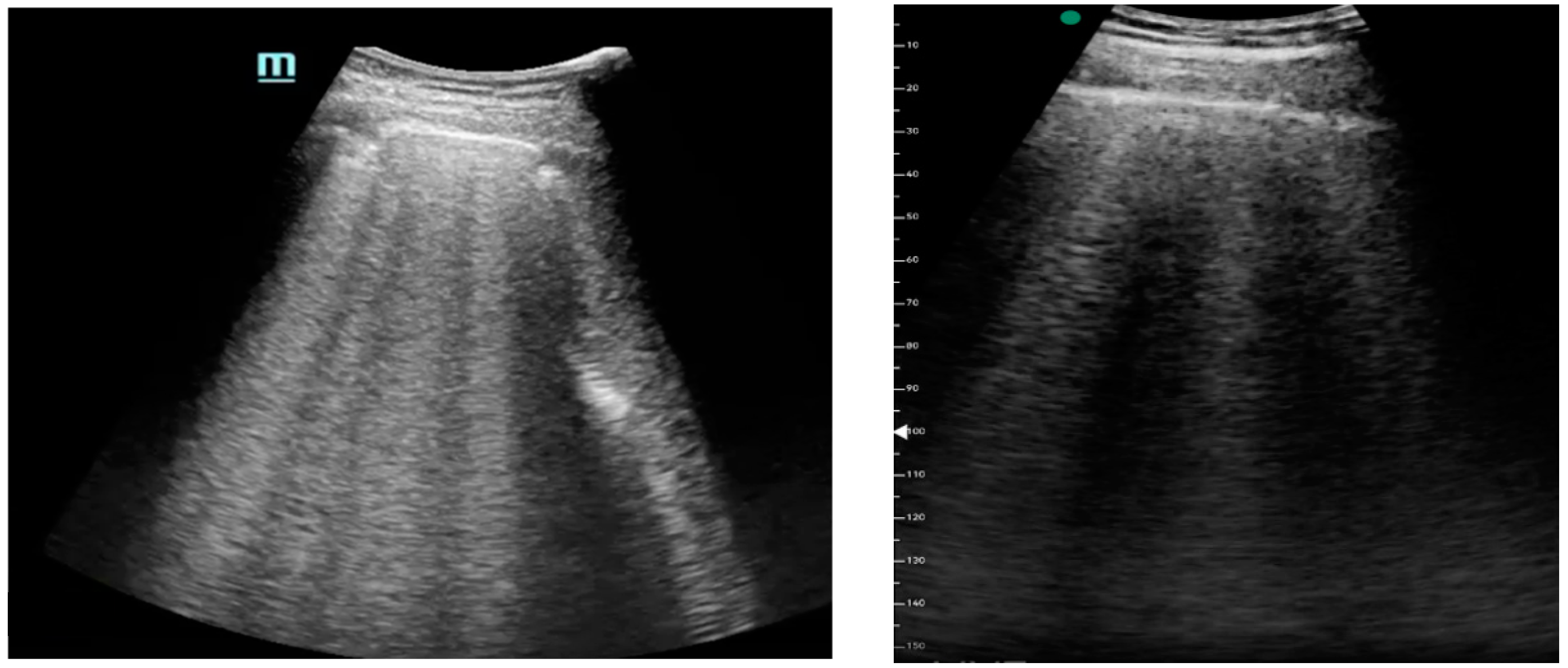 Medicina 61 00313 g001