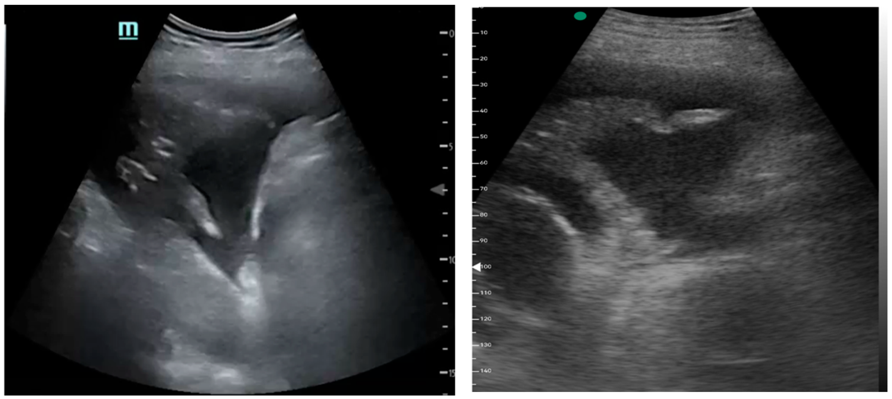 Medicina 61 00313 g003