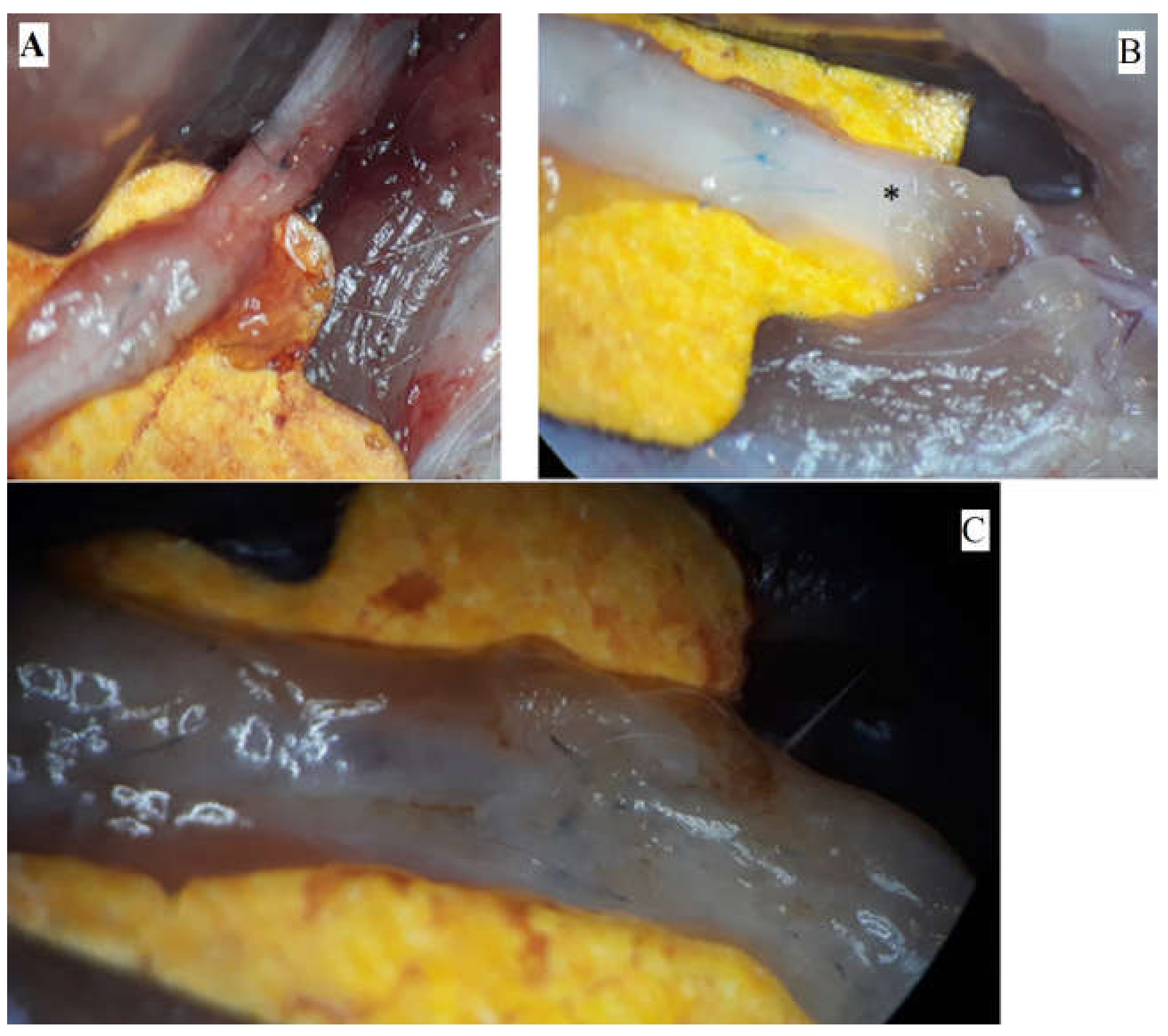 Medicina 61 00317 g001