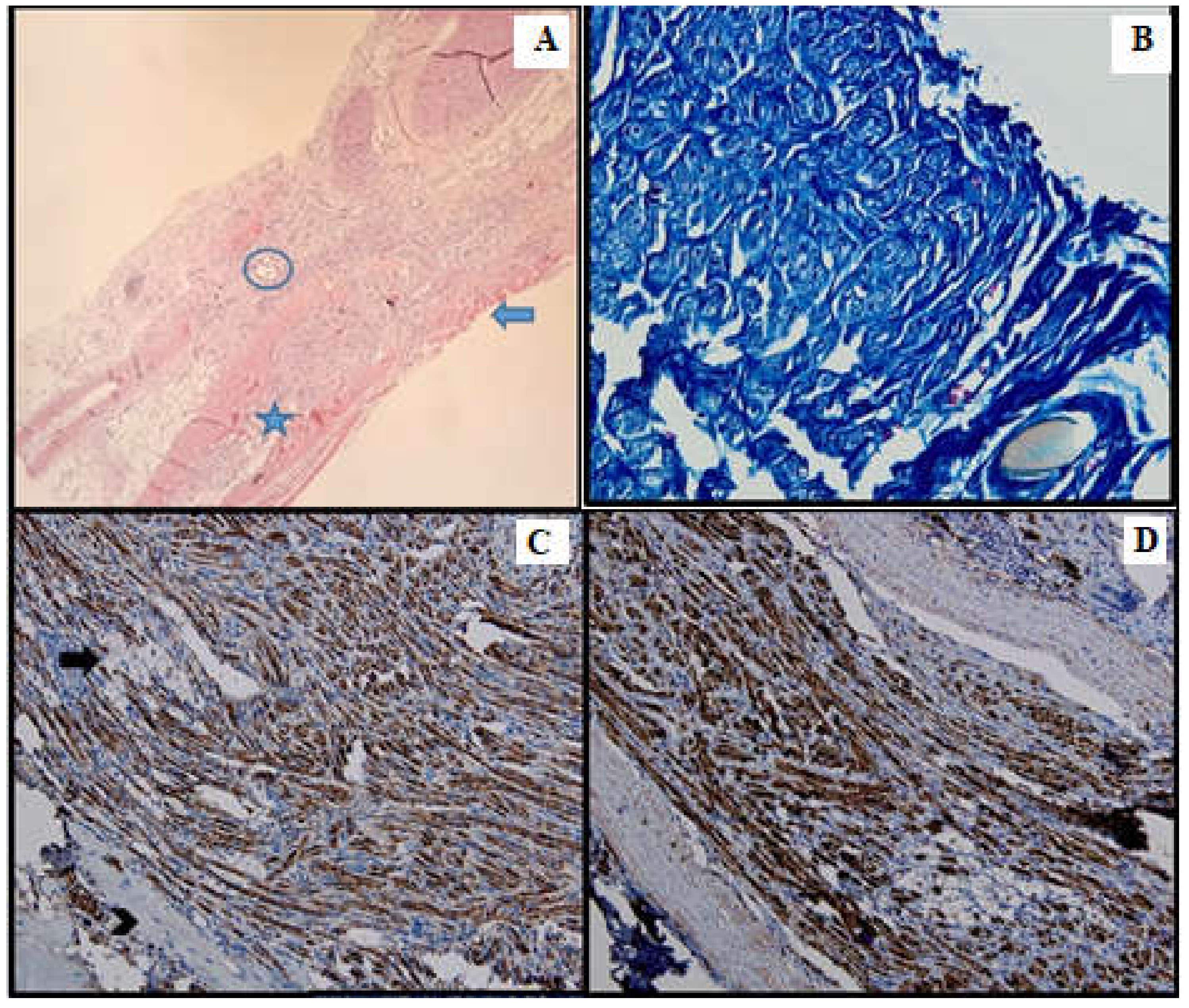 Medicina 61 00317 g004