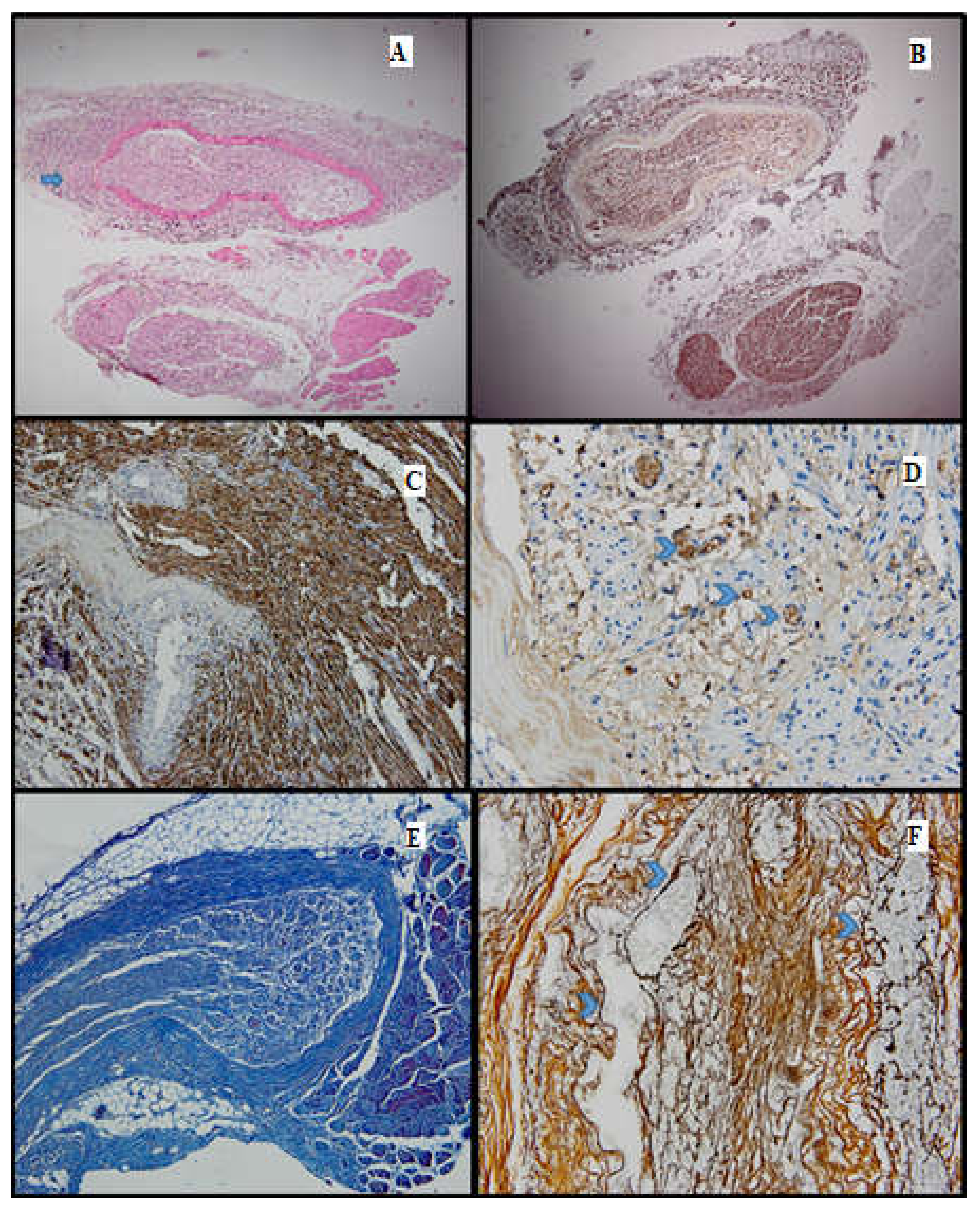 Medicina 61 00317 g005
