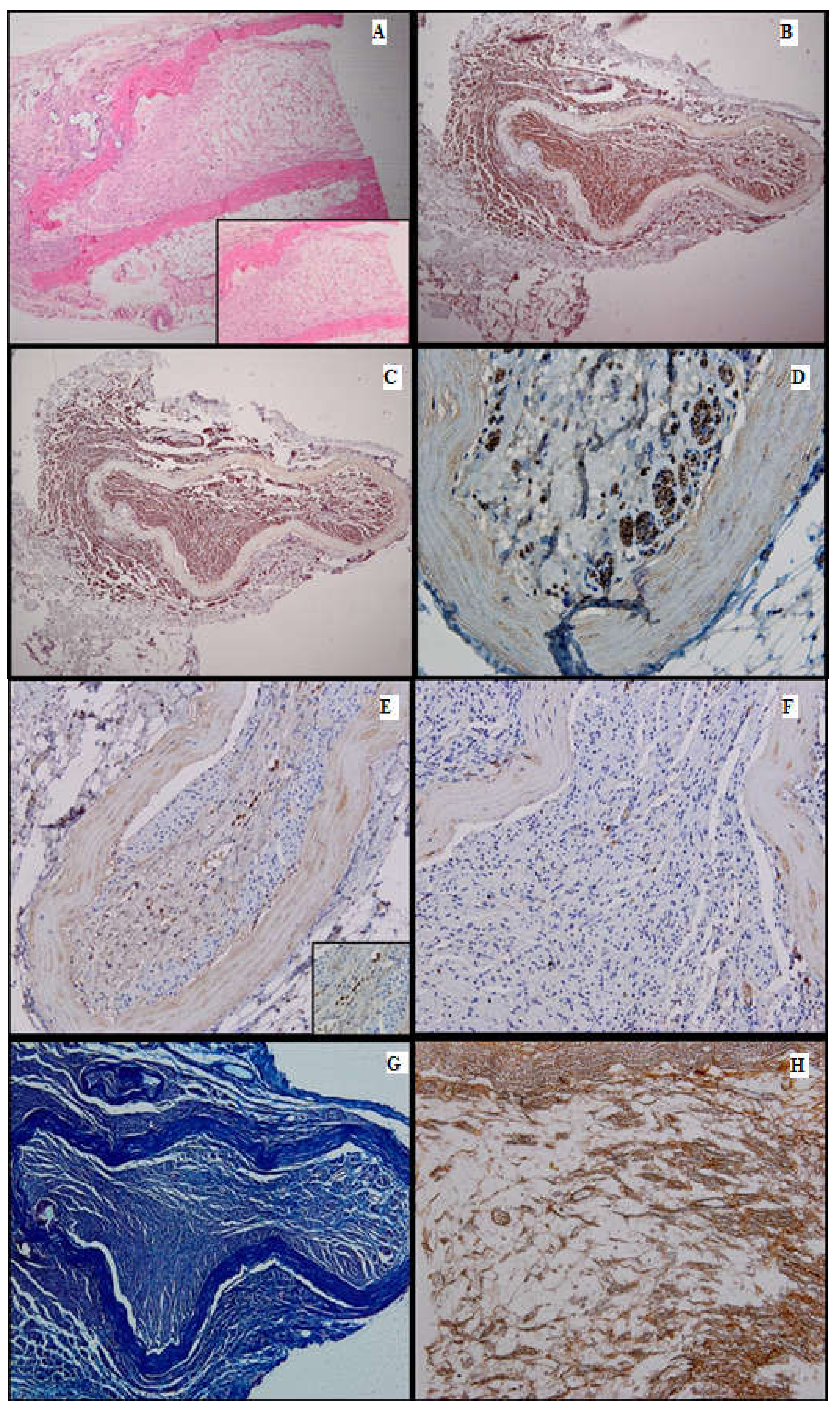 Medicina 61 00317 g006