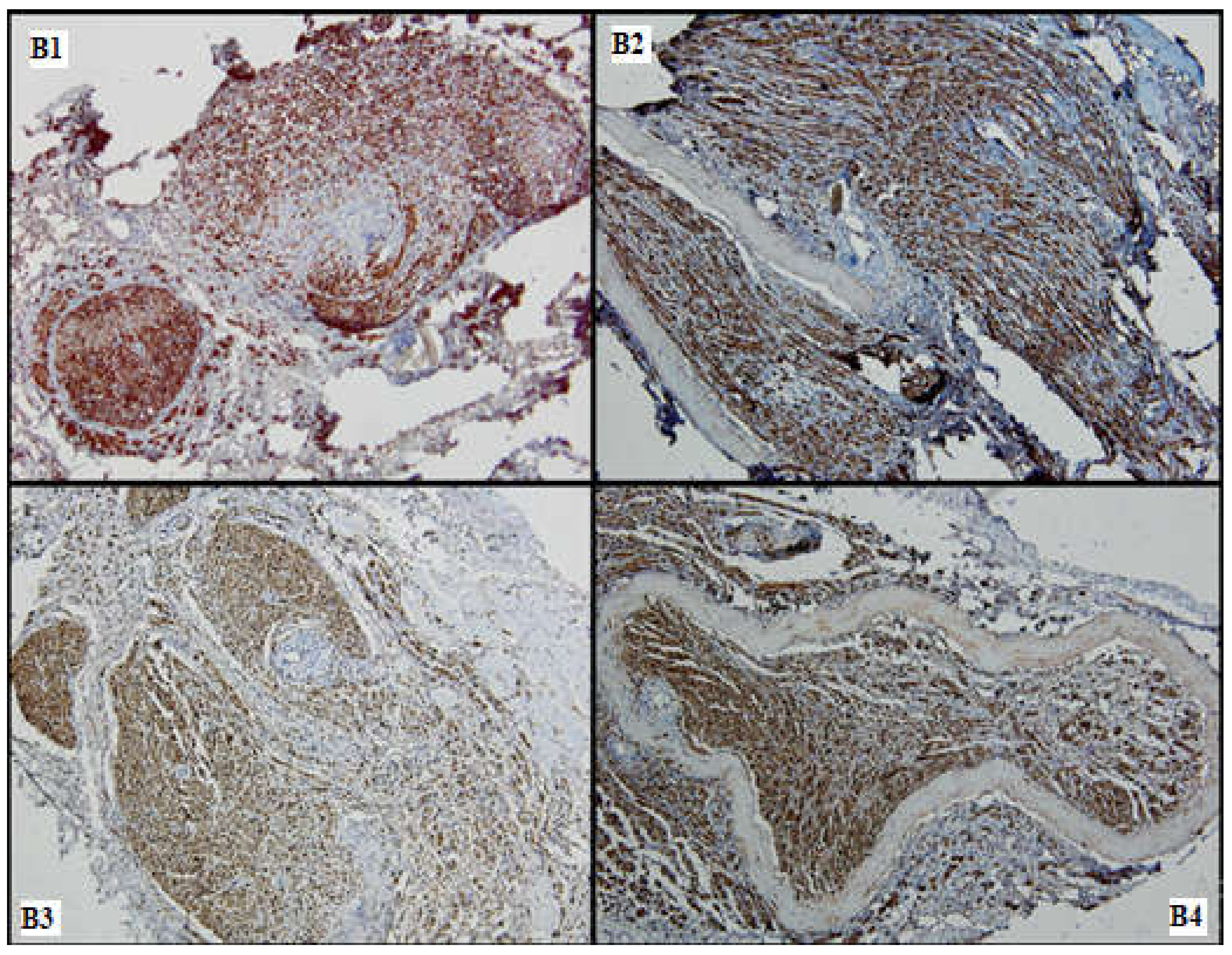 Medicina 61 00317 g007