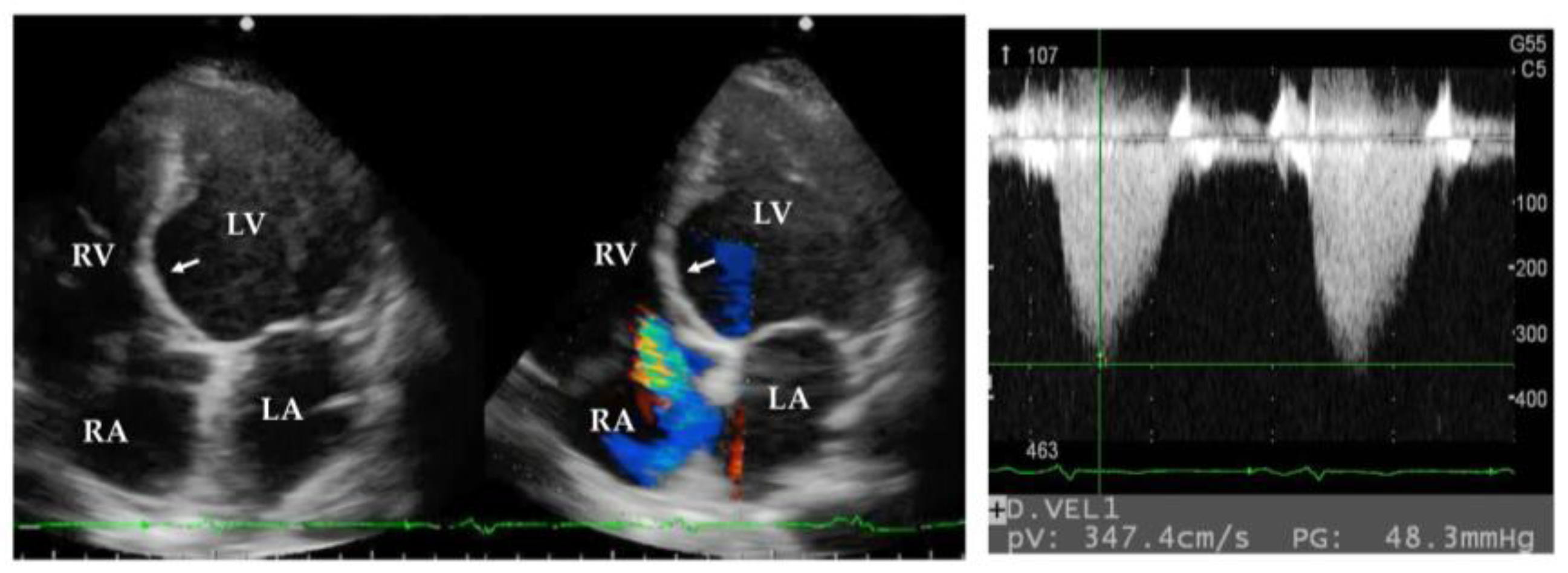 Medicina 61 00342 g002