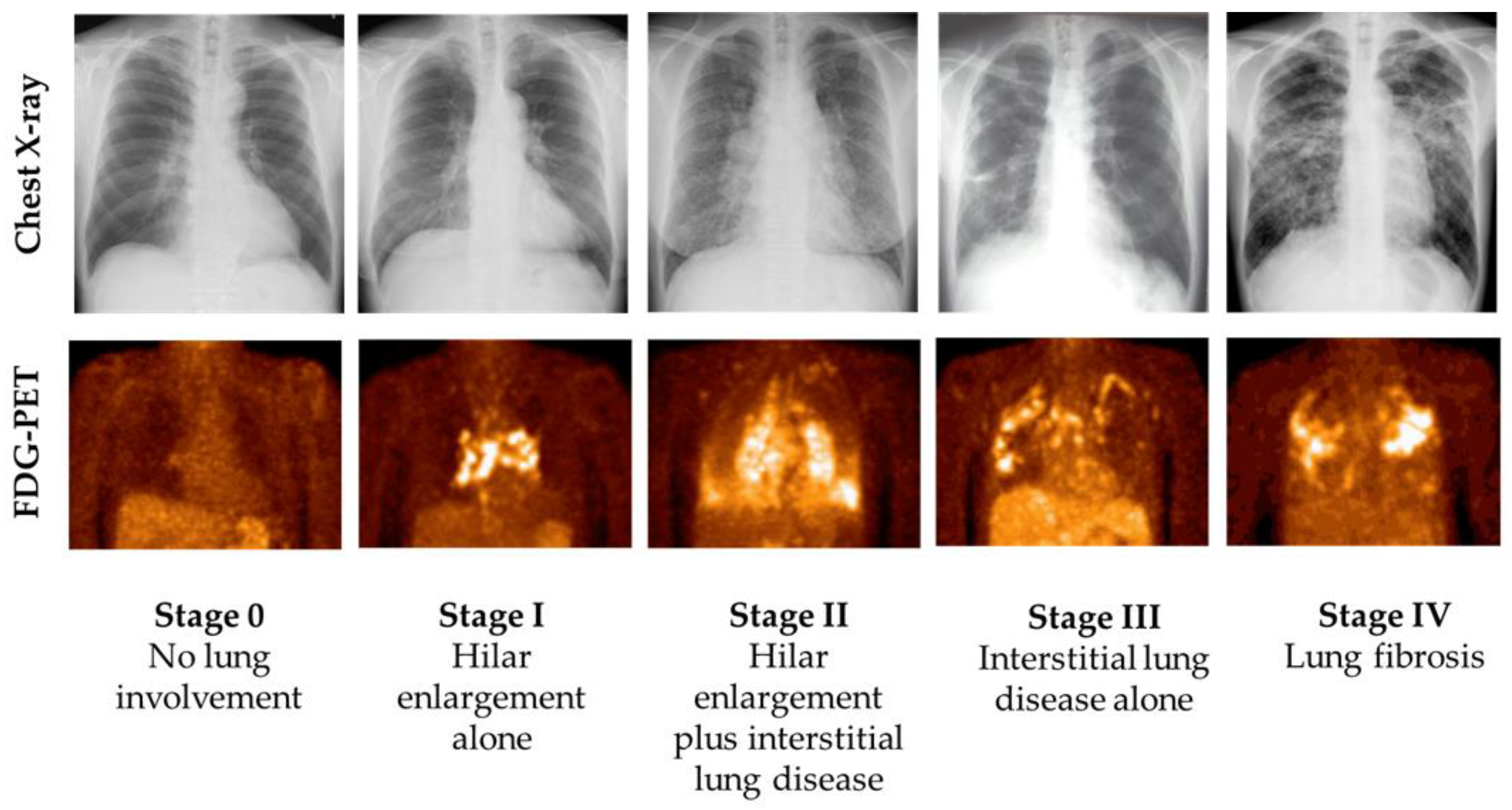 Medicina 61 00342 g003