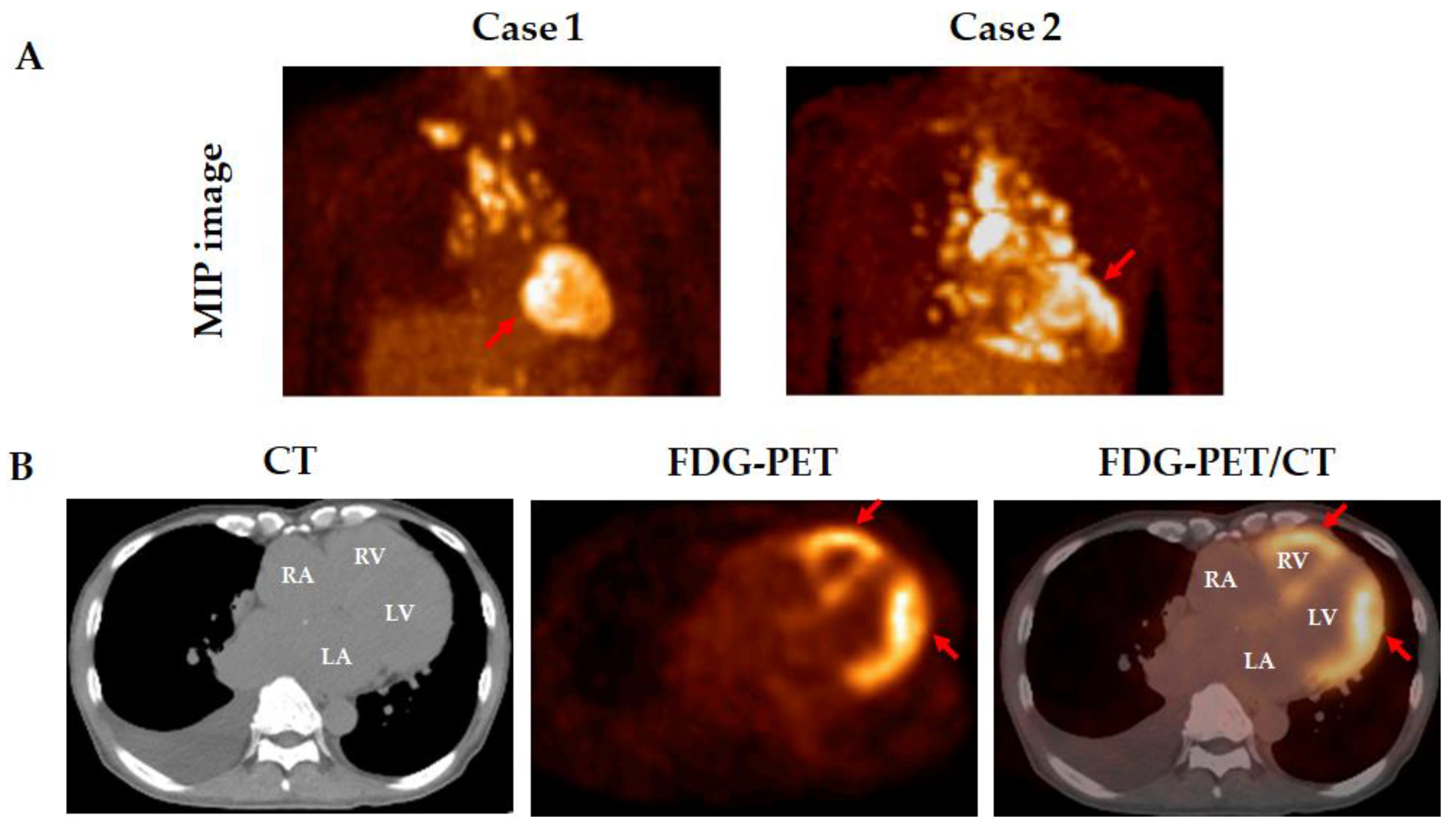 Medicina 61 00342 g004